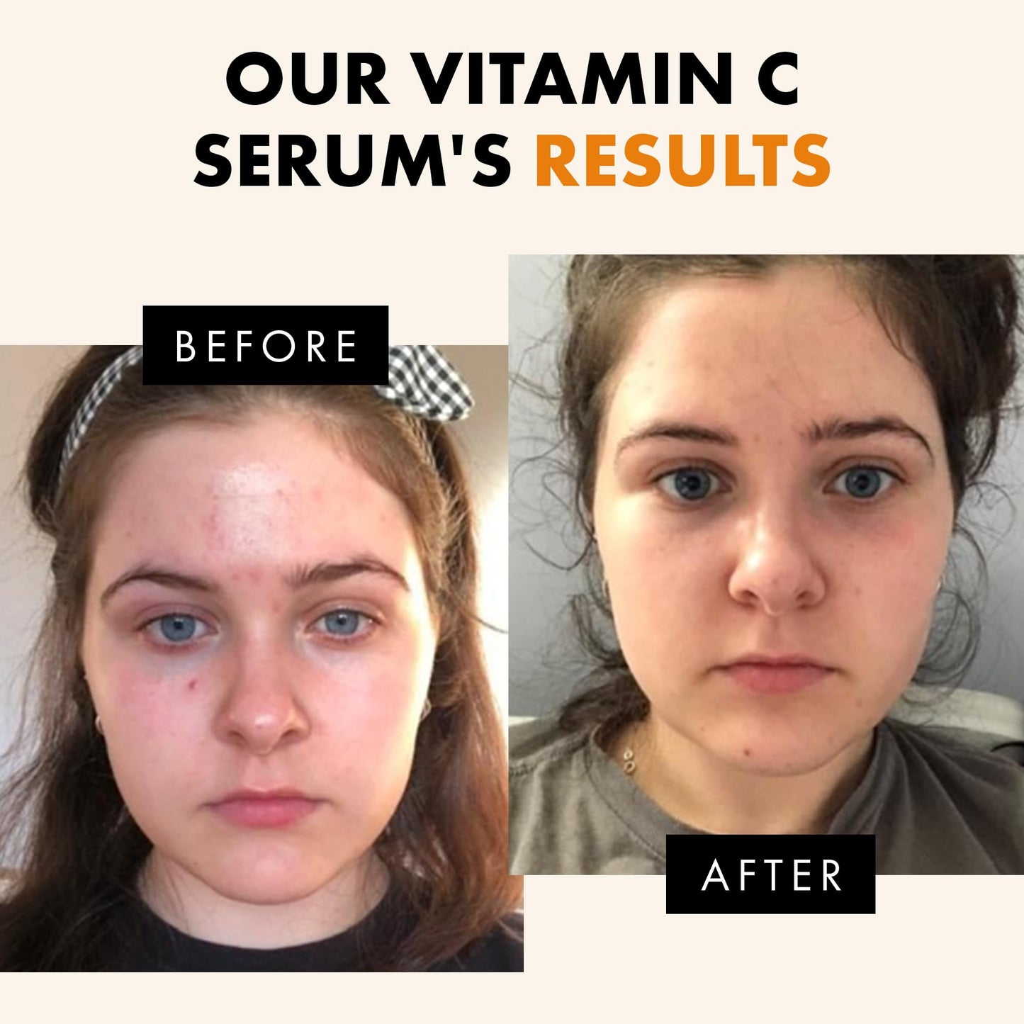 Eclat Skincare Vitamin C Face Serum - Skin Care for Dark Spots, Vitamin C Serum with Hyaluronic Acid, Ferulic Acid, & Vit E - Anti Aging and Skin Brightening, Pure Vit C Facial Care - 30 ml - Medaid International