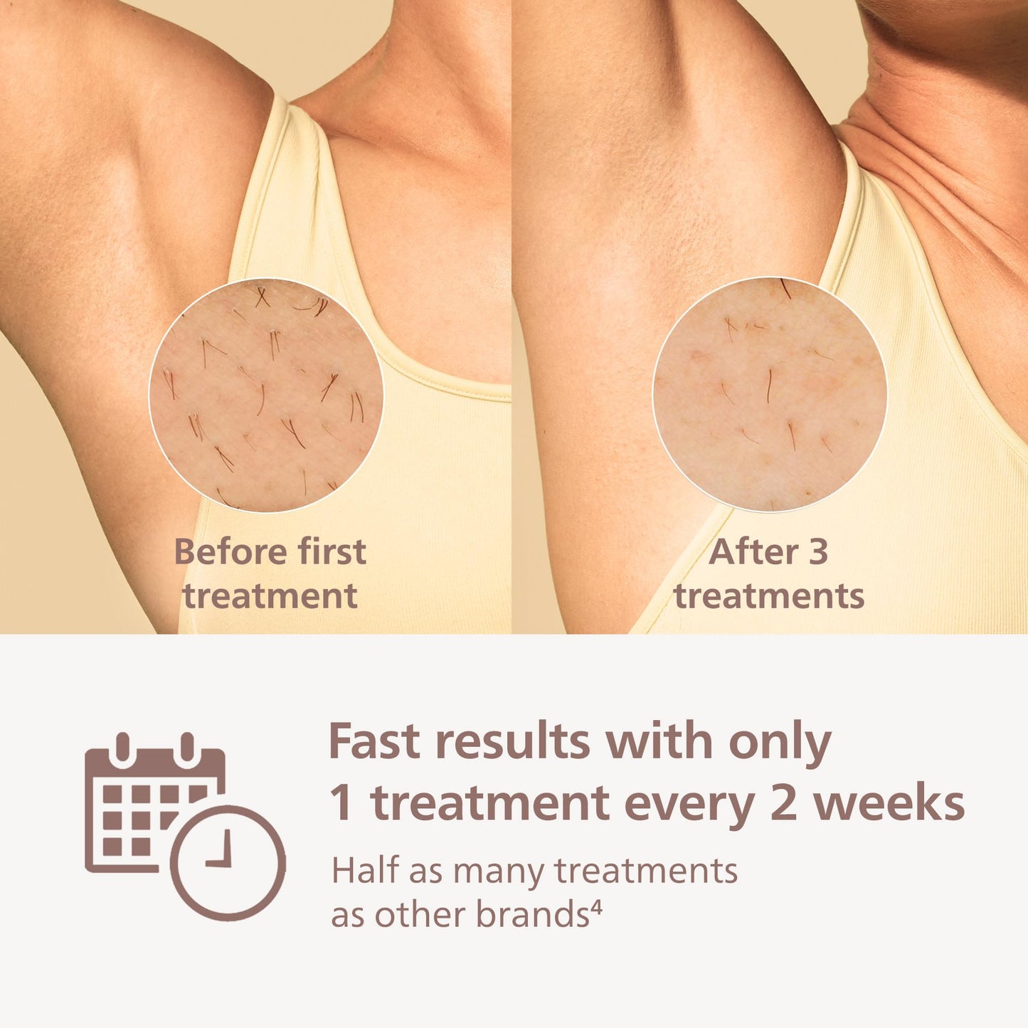 Philips Lumea 8000 Series IPL Hair Removal Device - Permanent Visible Hair Reduction Done at Home, SenseIQ Technology, 2 Attachments for Body & Face, for Women & Men, BRI932/03 - Medaid International