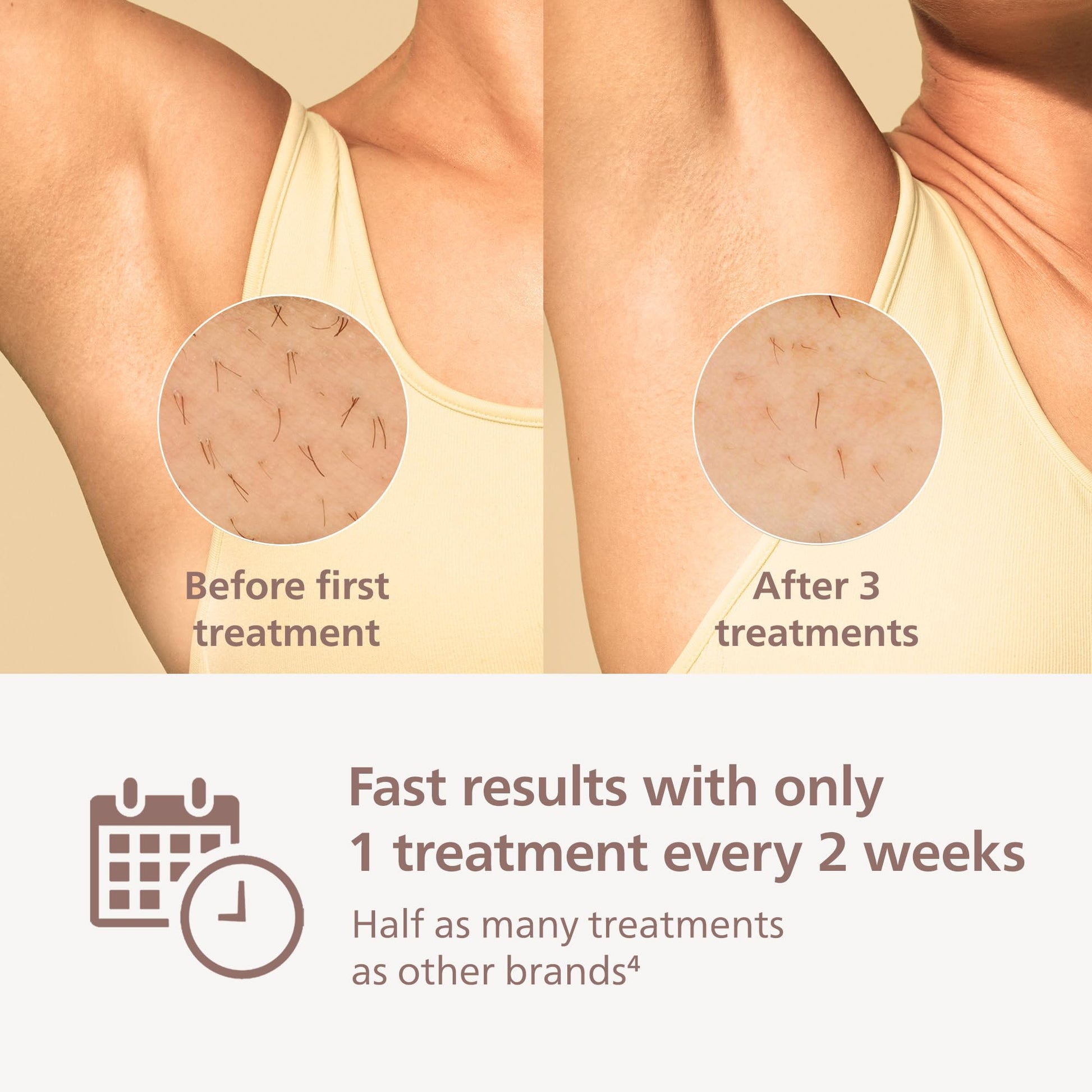 Philips Lumea 9000 Series IPL Hair Removal Device - Permanent Visible Hair Reduction Done at Home, SenseIQ Technology, 4 Attachments for Body, Face, Bikini & Underarms, for Women & Men, BRI984/03 - Medaid International