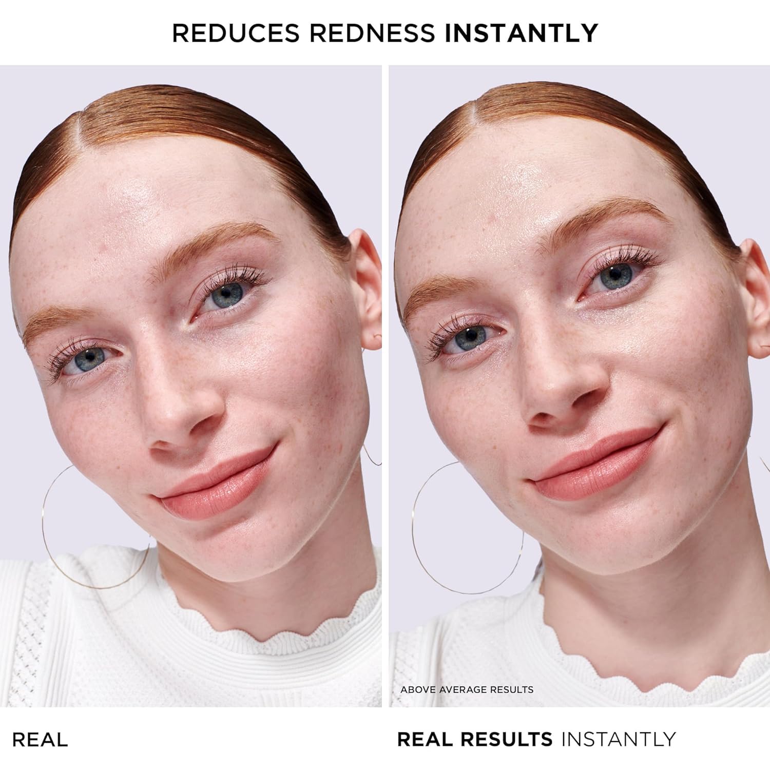 IT Cosmetics Bye Bye Redness Serum - Skin-Calming & Hydrating Face Serum - Instantly Neutralizes Facial Redness - 1% Colloidal Oatmeal, Centella, Peptide & Niacinamide – All Skin Types - 1 fl oz - Medaid International