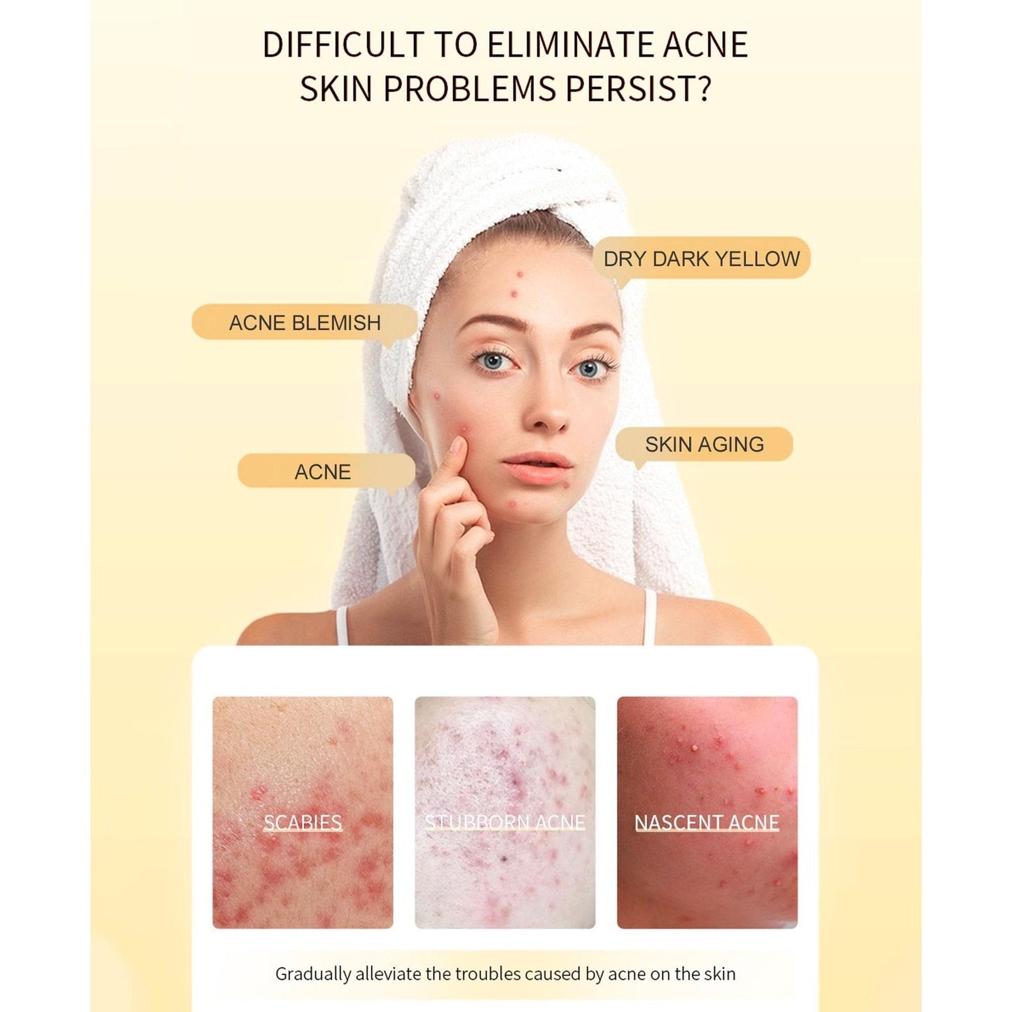 Propolis and Niacinamide Hydrating Facial Soothing Moisturizer, Glow Boosting Serum for Face for Acne-prone&Sensitive skin, Minimize breakouts, Korean skincare 30ml, 1 fl.oz - Medaid International