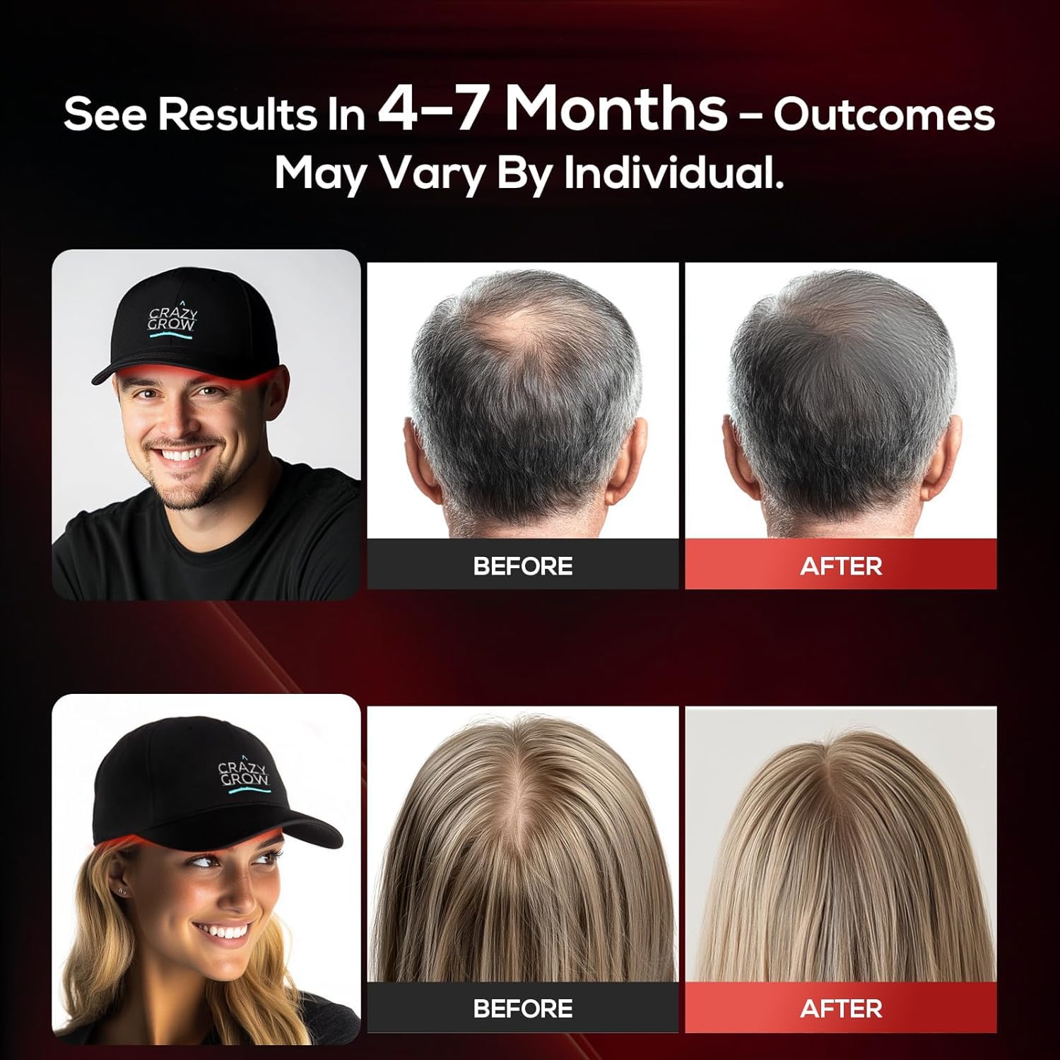 Laser Hair Growth Cap, Low Level Laser Therapy (LLLT) Device Designed to Promote Hair Growth in Women and Men,Laser Cap - Medaid International