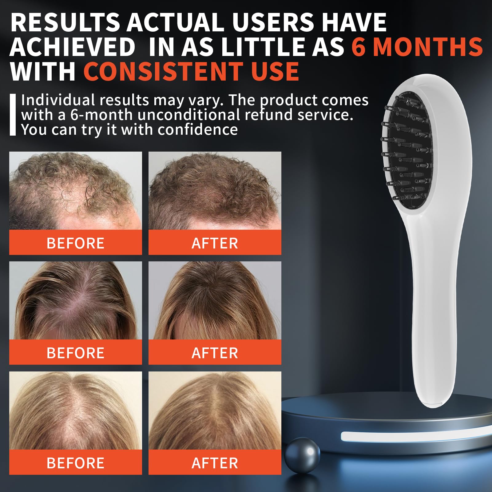 PUPCA Laser Therapy Hair Growth Comb, Hand-Held Comb-Shaped Low Level Laser Therapy To Promote Hair Growth in Women and Men - Medaid International