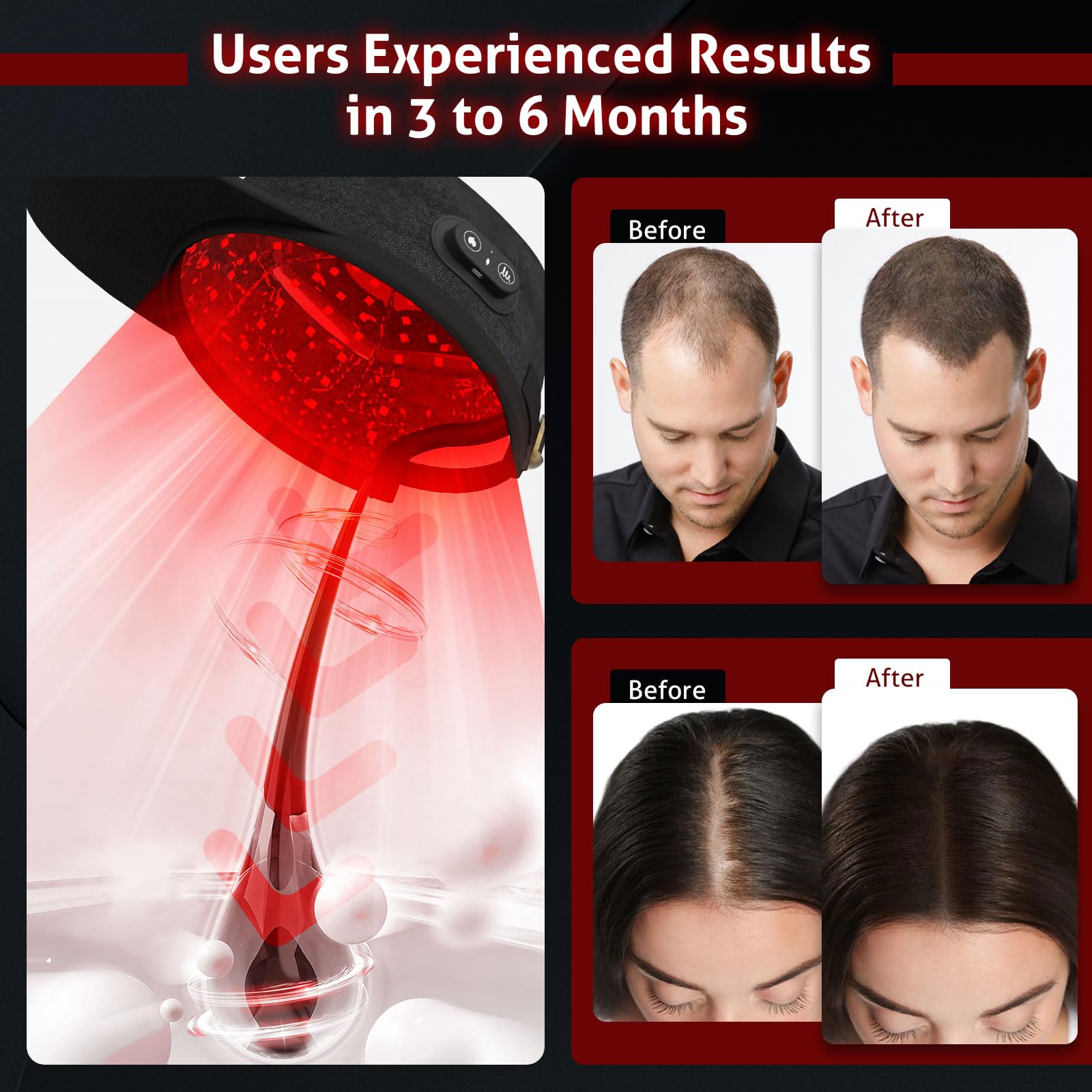 Laser Cap for Hair Growth, Wireless Red Light Therapy for Hair Growth, Strengthen Hair Roots, Hair Loss Treatment for Men and Women - Medaid International