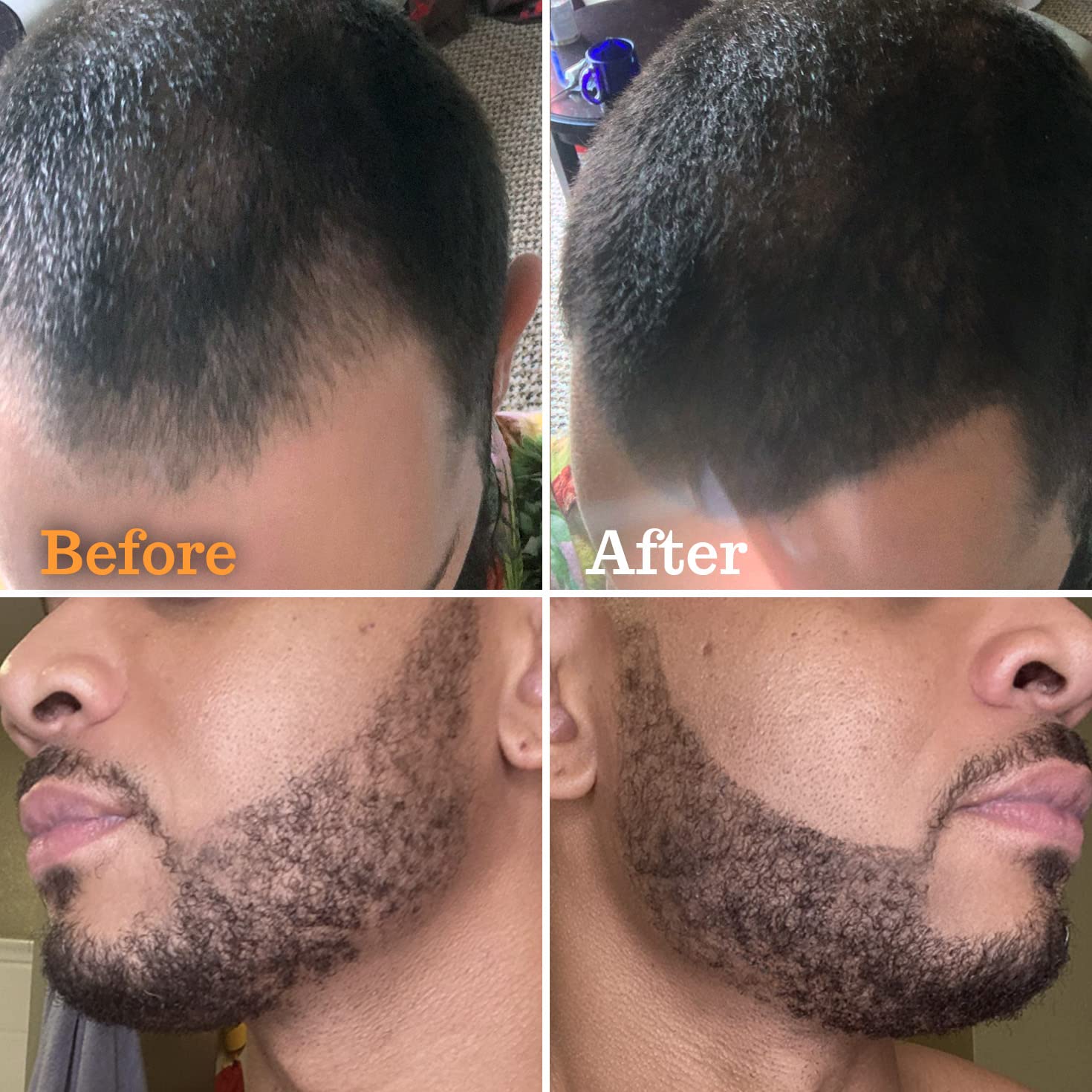 Beard Pen Filler for Men - Barber Styling Grooming Pencil - Waterproof, Sweat Proof, Long Lasting Solution with Natural Finish - Cover Beard and Scalp Patches in Seconds - Medium Black 1 Pack - Medaid International