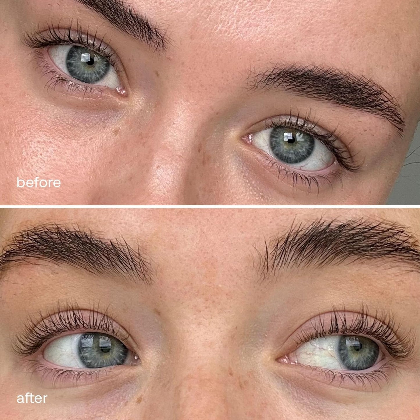 UKLASH Eyelash Complex Serum - #1 Rated Lash Serum for Longer, Stronger Lashes - Cruelty-free, Prostaglandin & Paraben-free - Recommended for All Skin Tones - Medaid International