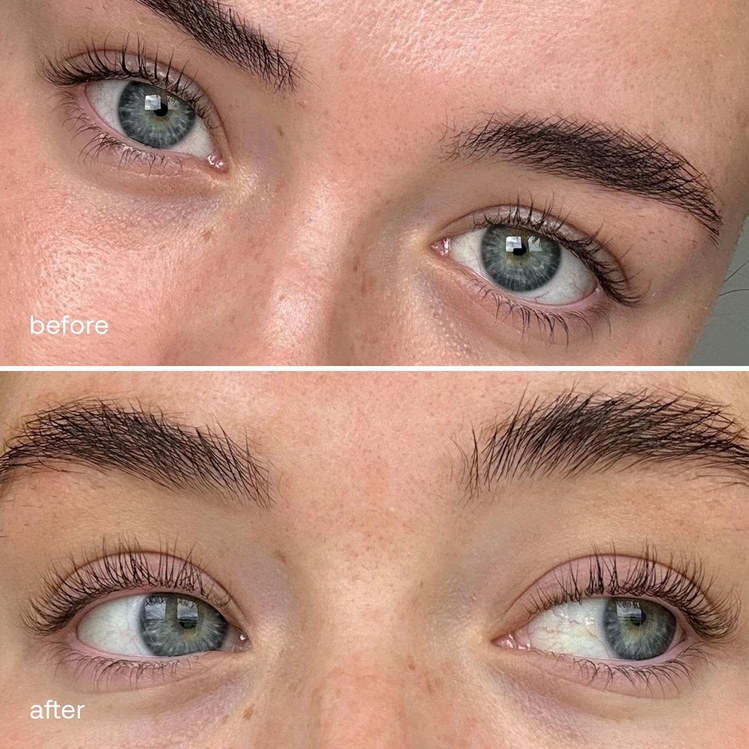 UKLASH Eyelash Complex Serum - #1 Rated Lash Serum for Longer, Stronger Lashes - Cruelty-free, Prostaglandin & Paraben-free - Recommended for All Skin Tones - Medaid International