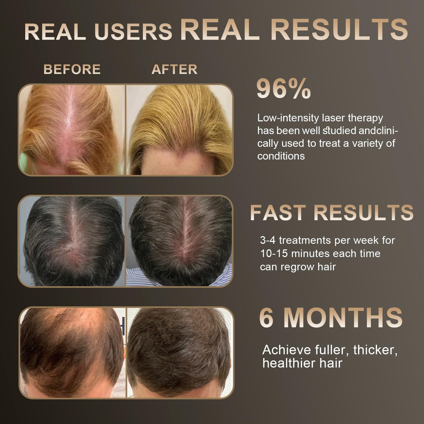 Laser Hair Growth Comb, Hair Growth Device, promote hair growth in women and men - Medaid International