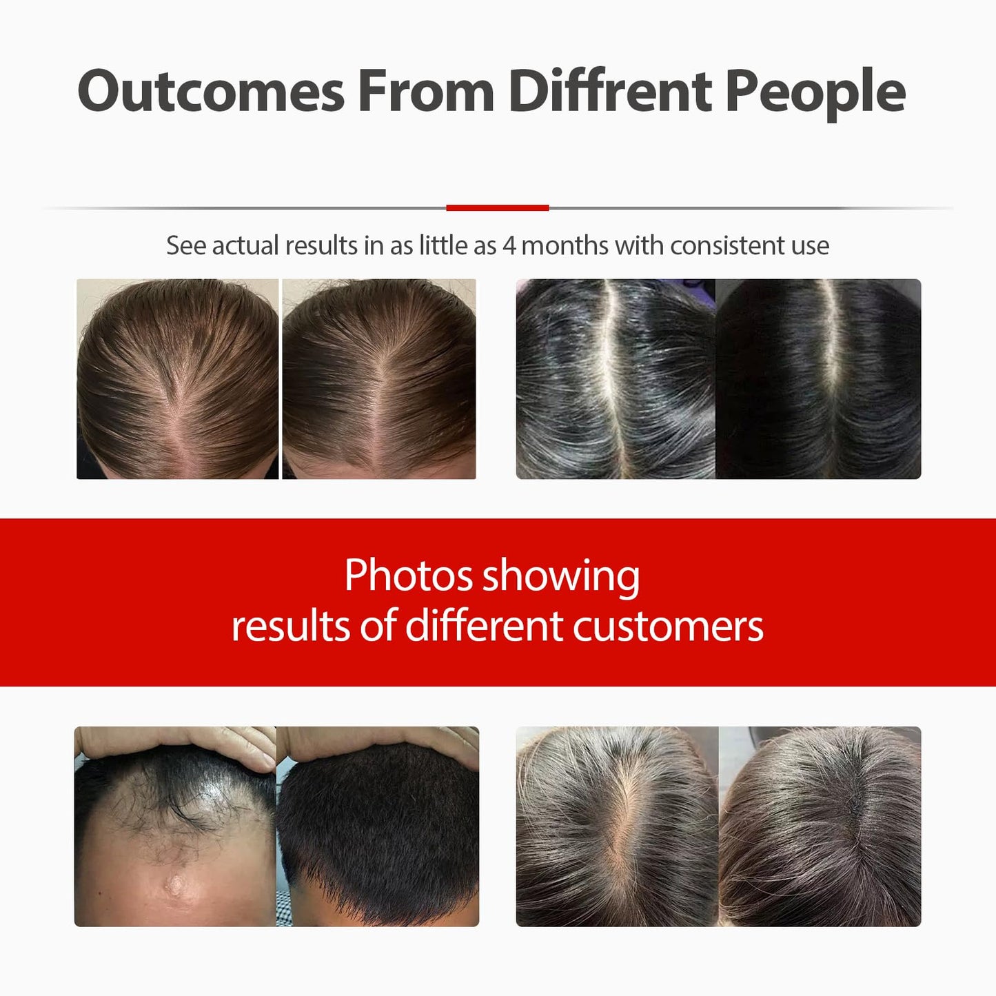 Laser Cap, Red Light Therapy for Hair Growth in Women and Men - Medaid International
