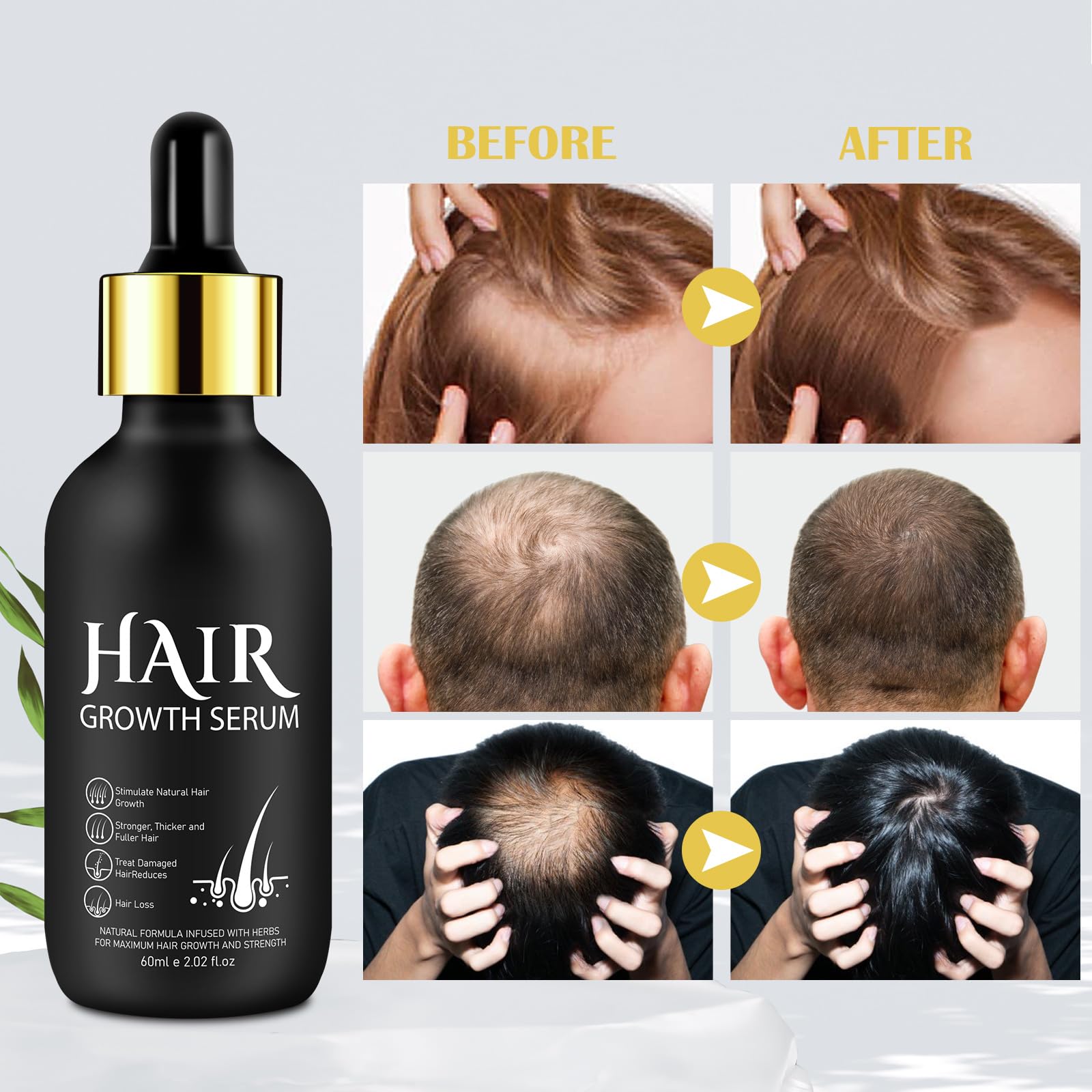 Minoxidil for Men, 5% Minoxidil for Women, Hair Growth Serum for Womens Stronger Thicker Longer Hair, Natural Hair Growth Oil for Mens Beard Growth, Minoxidil for Women & Men, 60ML - Medaid International