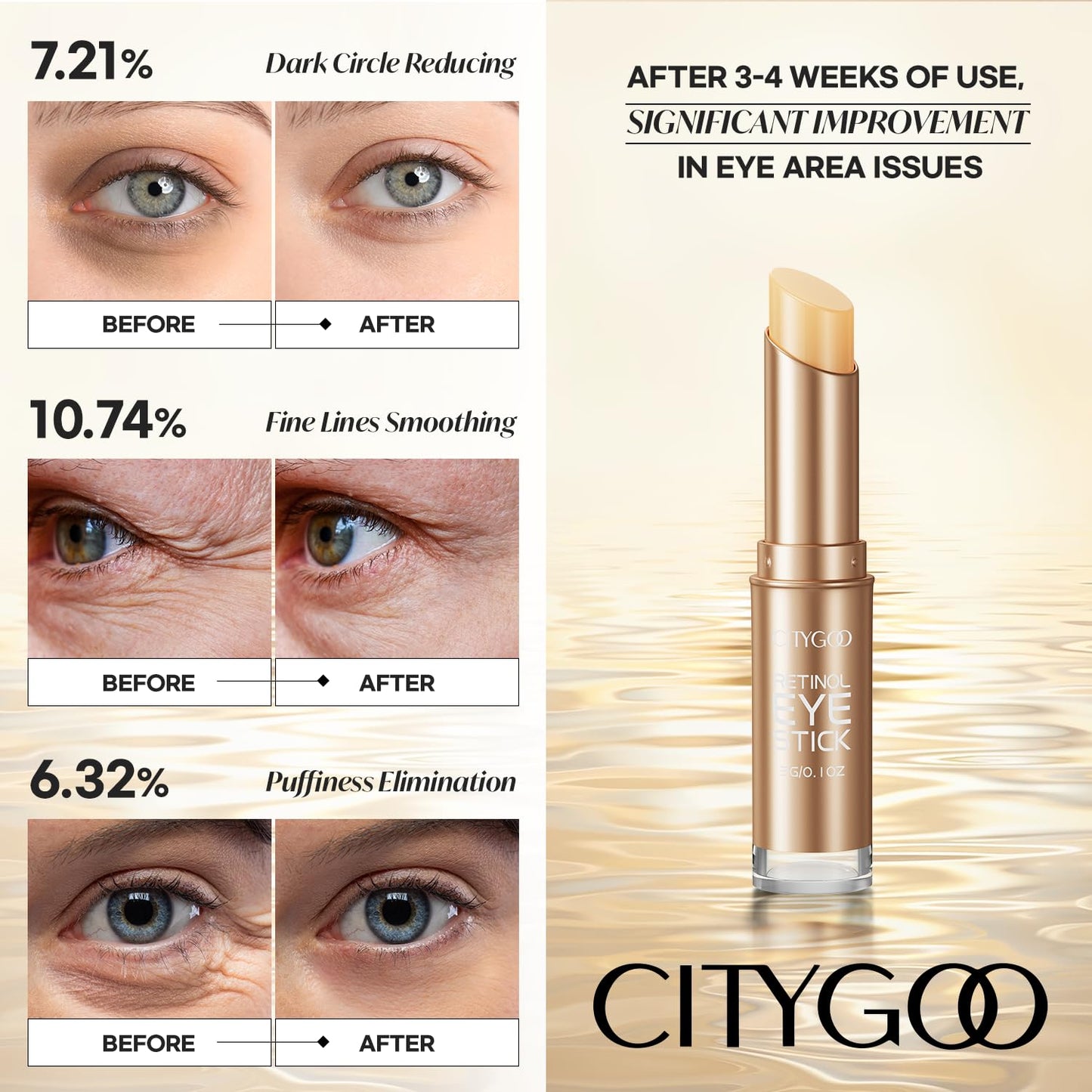 CITYGOO Retinol Eye Stick With Collagen, Hyaluronic Acid For Dark Circle, Under Eye Cream Anti Aging, For Puffiness and Bags Reduces Fine Lines (Retinol Eye Stick, 1pcs) - Medaid International