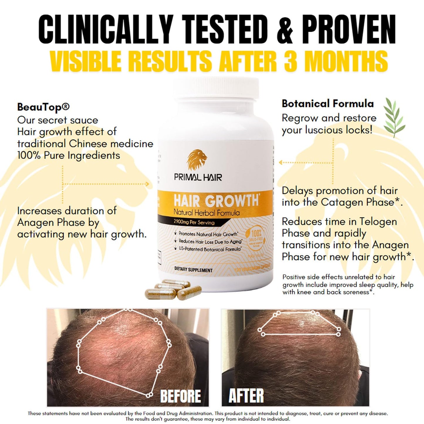 Primal Hair 3 PK- 100% Natural Growth Treatment, Reduces Hair Loss, US Patented Formula Proven Effective for Men & Women, 100% Vegan, Non-GMO, 90-Day Supply, 3 Pack - Medaid International
