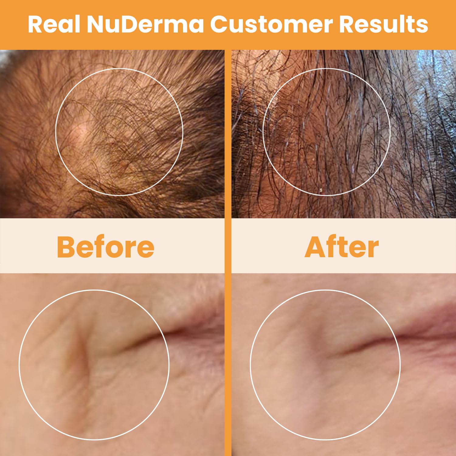 Pure Daily Care NuDerma Handheld Skin Therapy Wand Machine w/Neon – Anti-Aging - Skin Tightening - Wrinkle Reducing - Dark Circles – Clarifying - Hair & Scalp Stimulator - Medaid International