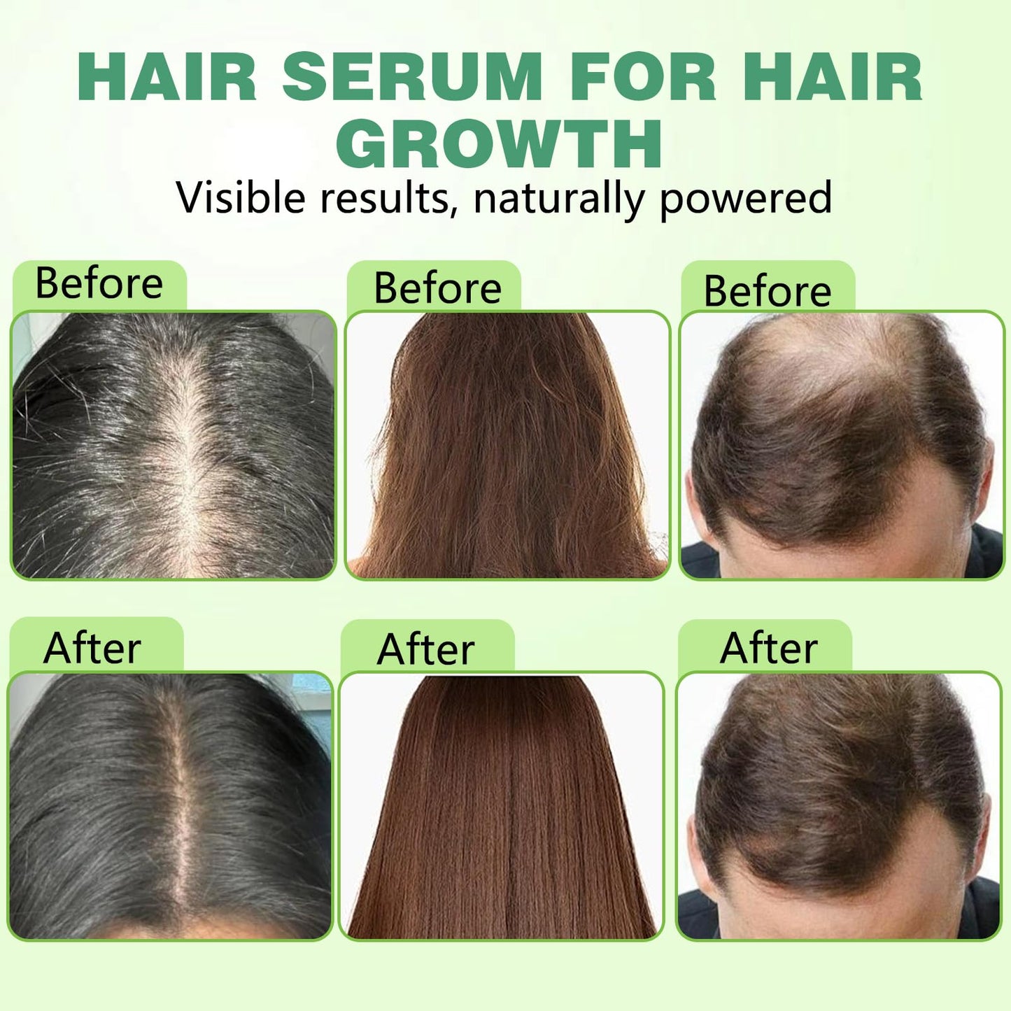 Hair Regrowth System, Advanced Hair Growth Treatment Ginseng, Eclipta Prostrata,Peppermint Oil & Ginger Root,Strengthens Hair Roots,Thickening Serum for Men & Women (1 Set) - Medaid International