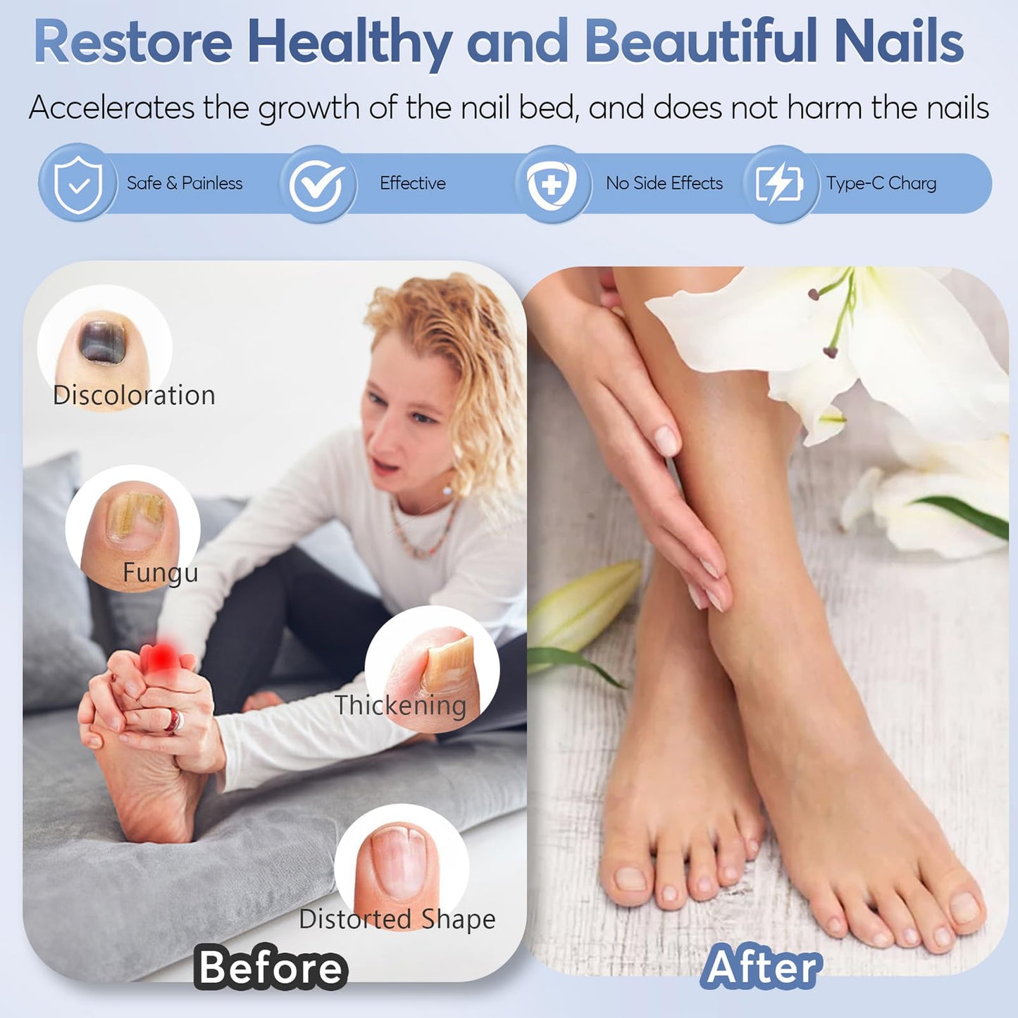 Nail Fungus Laser Treatment Led Light Device - Nail Fungal Infections, Significantly Improve Symptoms Such As Deformation And Painful Walking(black) - Medaid International
