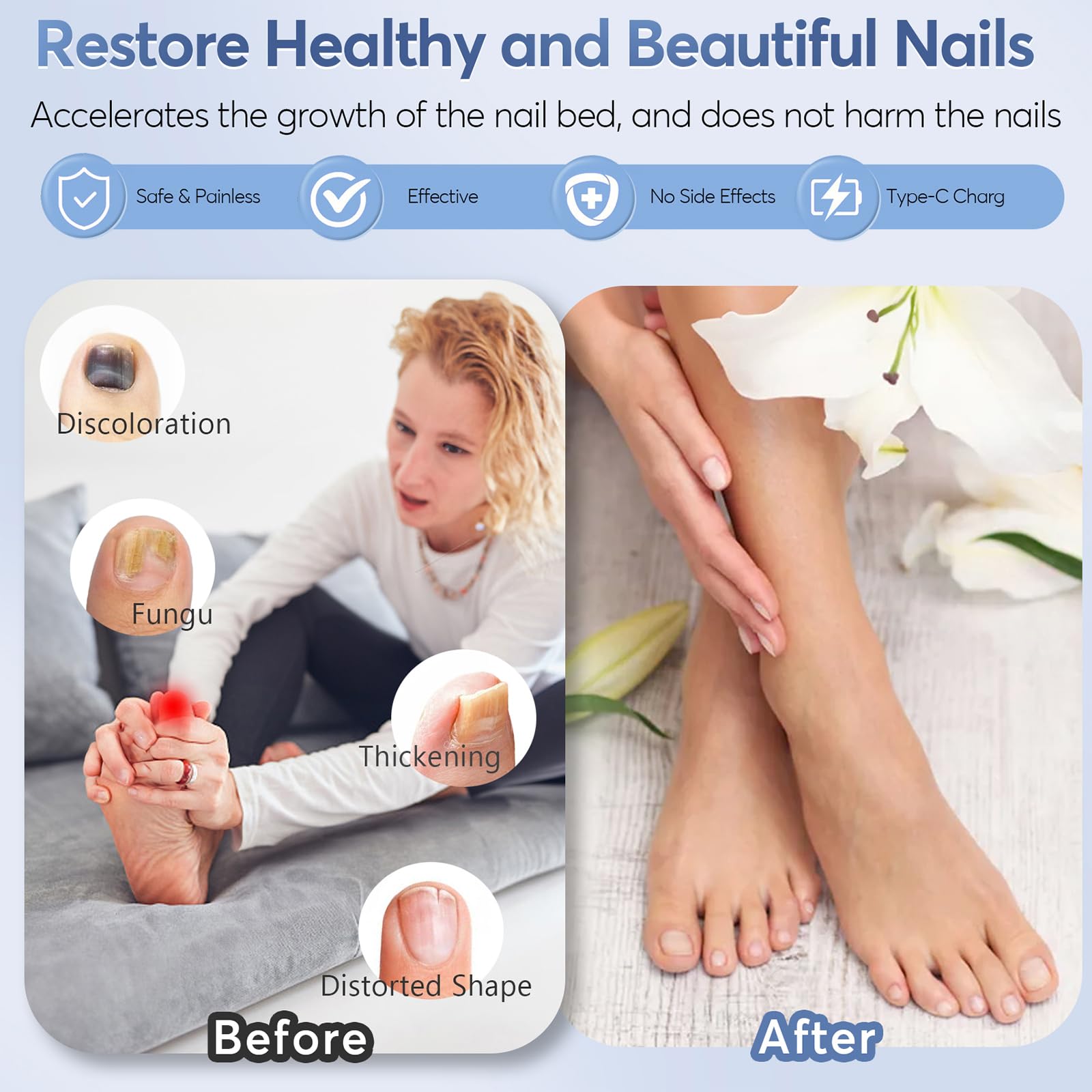 Nail Fungus Laser Treatment Led Light Device - Nail Fungal Infections, Significantly Improve Symptoms Such As Deformation And Painful Walking(black) - Medaid International