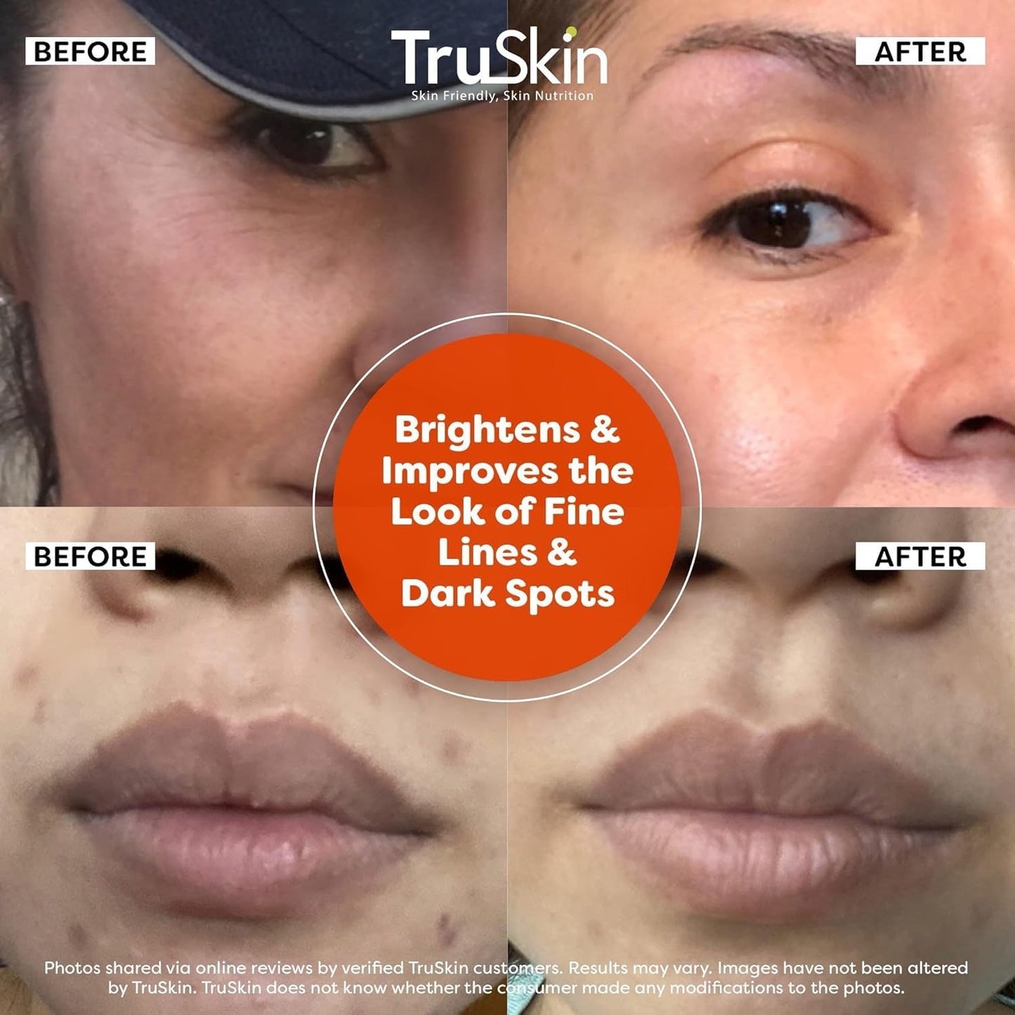 TruSkin Vitamin C Serum For Face – Anti Aging Face Serum with Vitamin C, Hyaluronic Acid, Vitamin E – Brightening Formula – Improve Appearance of Dark Spots, Tone, Fine Lines & Wrinkles, 1 Fl Oz - Medaid International