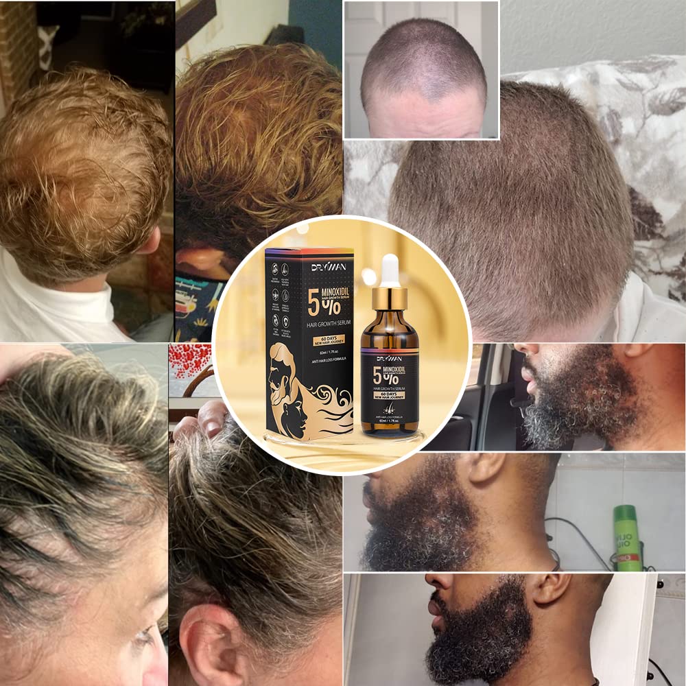 Dr.Yiman 5% Minoxidil Hair Growth Serum for Men and Women, Hair Growth Serum Oil for Hair Loss for Women, Safest Hair Growth Minoxidil Treatment for Boosting Follicles, Hair Regrowth Treatments - Medaid International