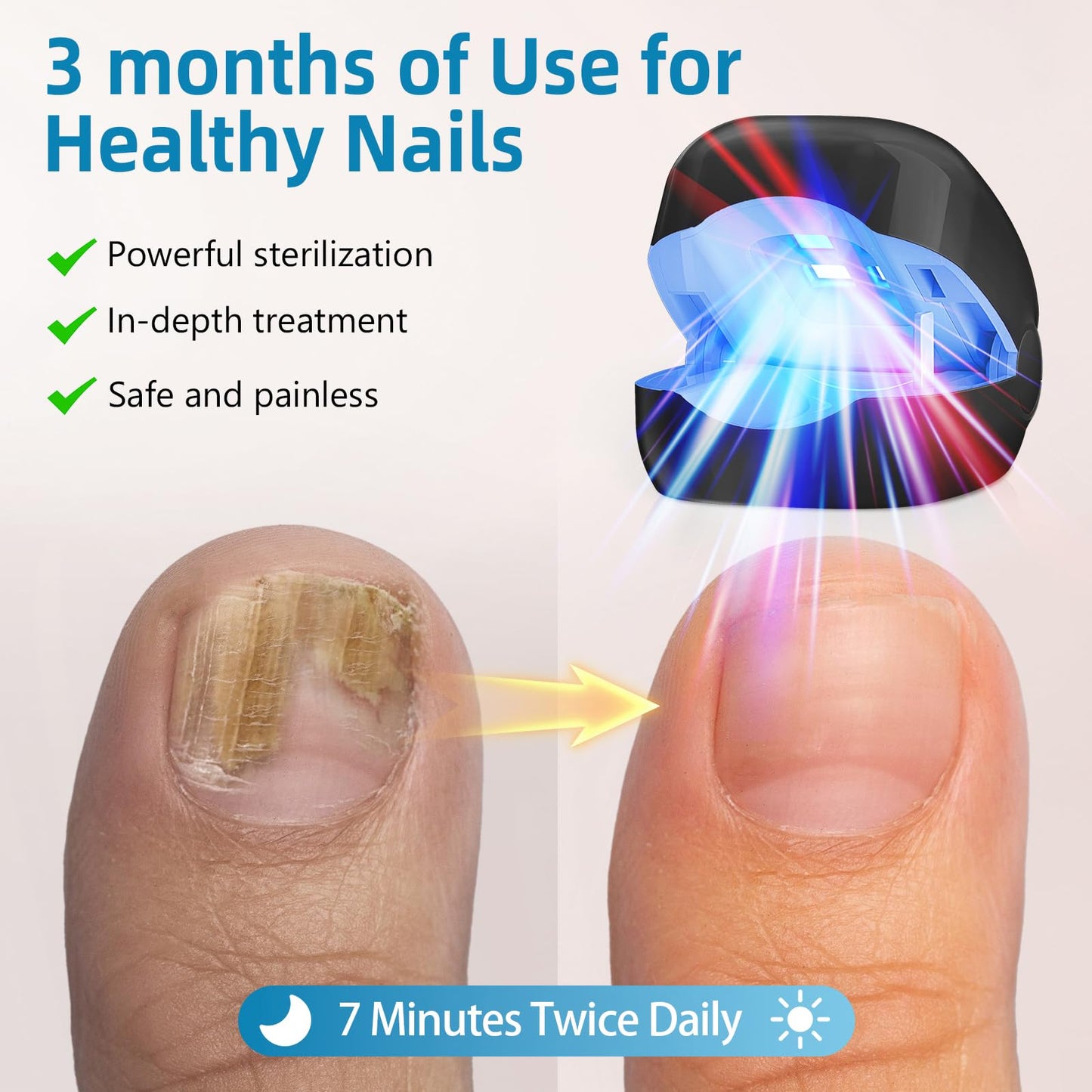 Nail Fungus Laser Treatment LED Light Device-Solution for Fungal Infections,Nail Fungus Laser Treatment Device for Damaged - Medaid International