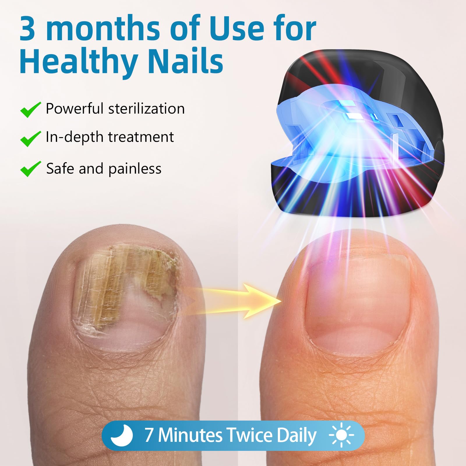 Nail Fungus Laser Treatment LED Light Device-Solution for Fungal Infections,Nail Fungus Laser Treatment Device for Damaged - Medaid International