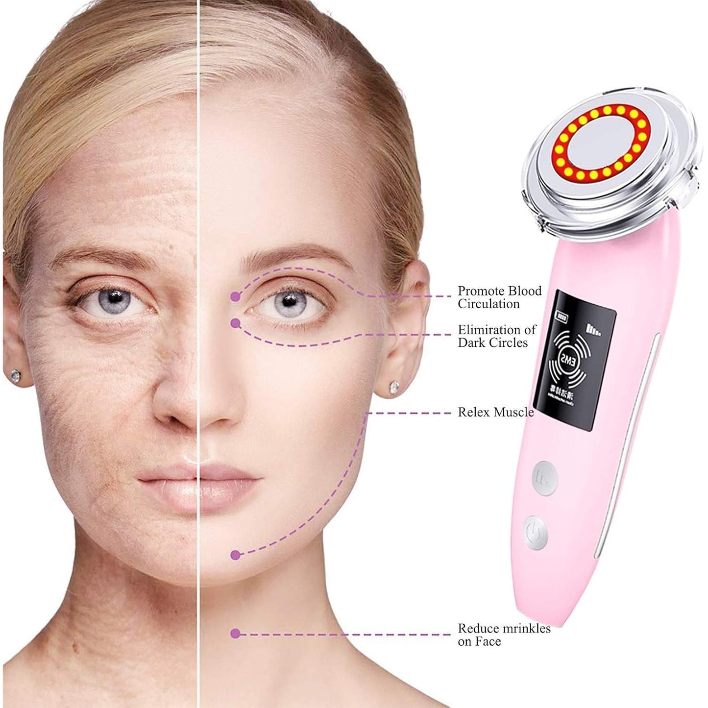 Skin Rejuvenation Device - Medaid International