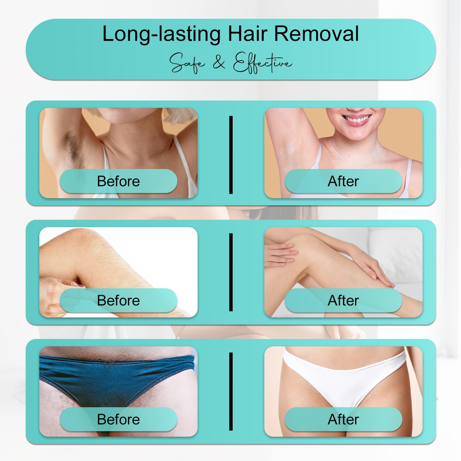 Professional IPL Laser Hair Removal Device & Epilator for Women and Men, 999,999 Flashes, Permanent Hair Reduction for Face, Legs, Arms, Bikini Line & Body, Painless Treatments for Smooth Skin at Home - Medaid International