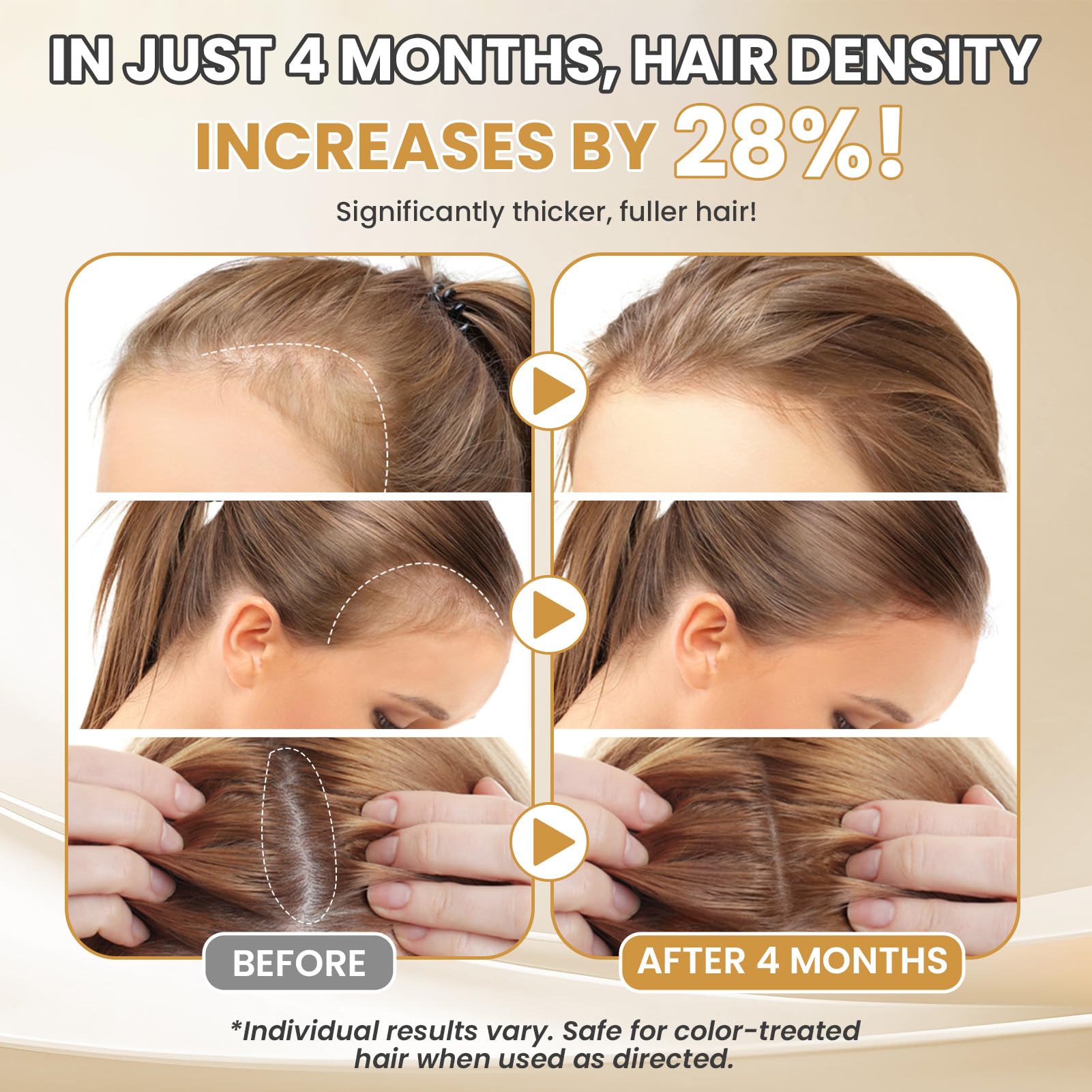5% Minoxidil for Women Hair Growth Serum Topical Minoxidil Hair Regrowth Thicker Prevent Hair Loss for Thickening Longer Fuller - Medaid International