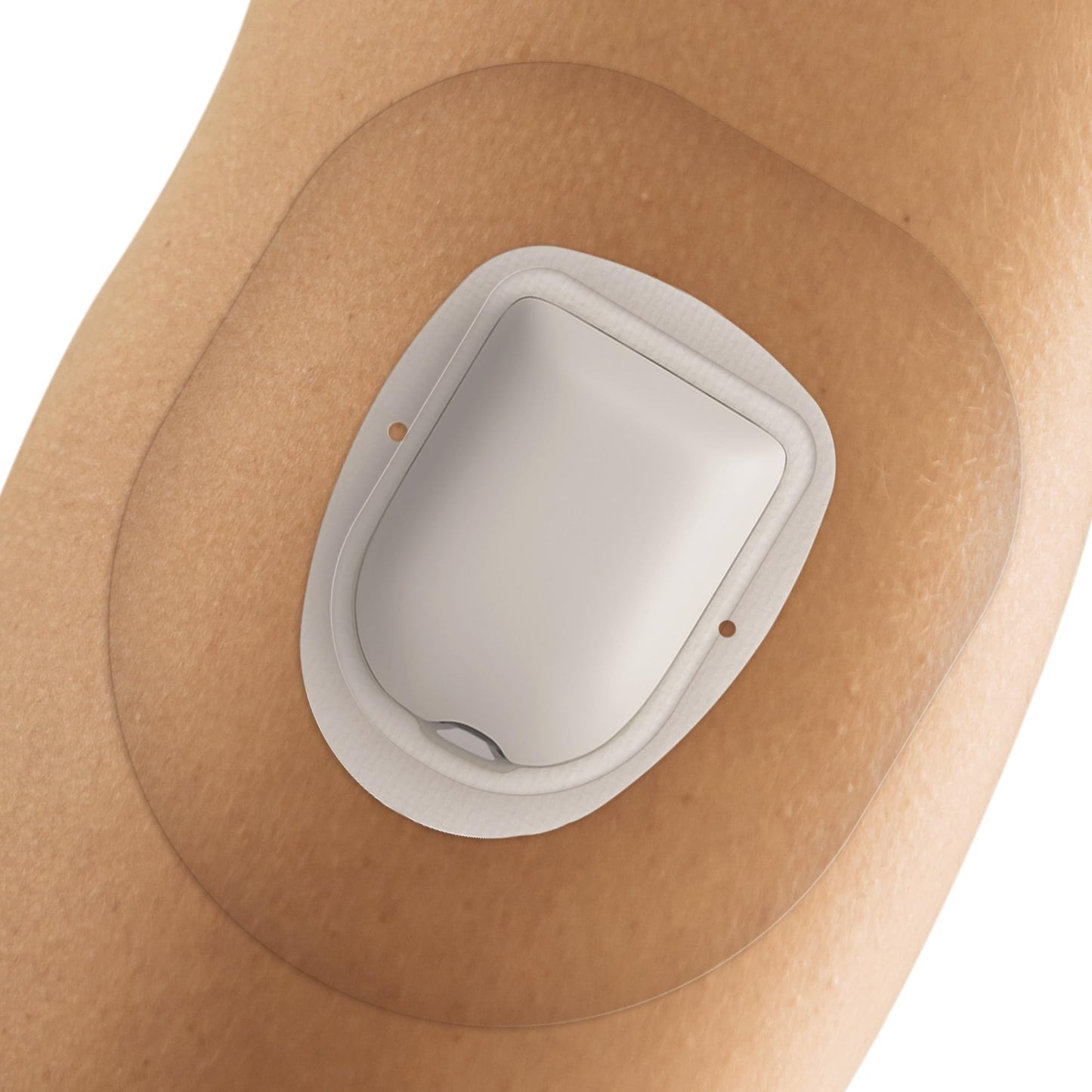 Fixic - 25 Pack - Adhesive Patches - Perfect for Omnipod - The Best Waterproof Adhesive Covers for Omnipod Sensors - Pre-Cut Back Paper - Long Fixation for Your Sensor! (Transparent) - Medaid International