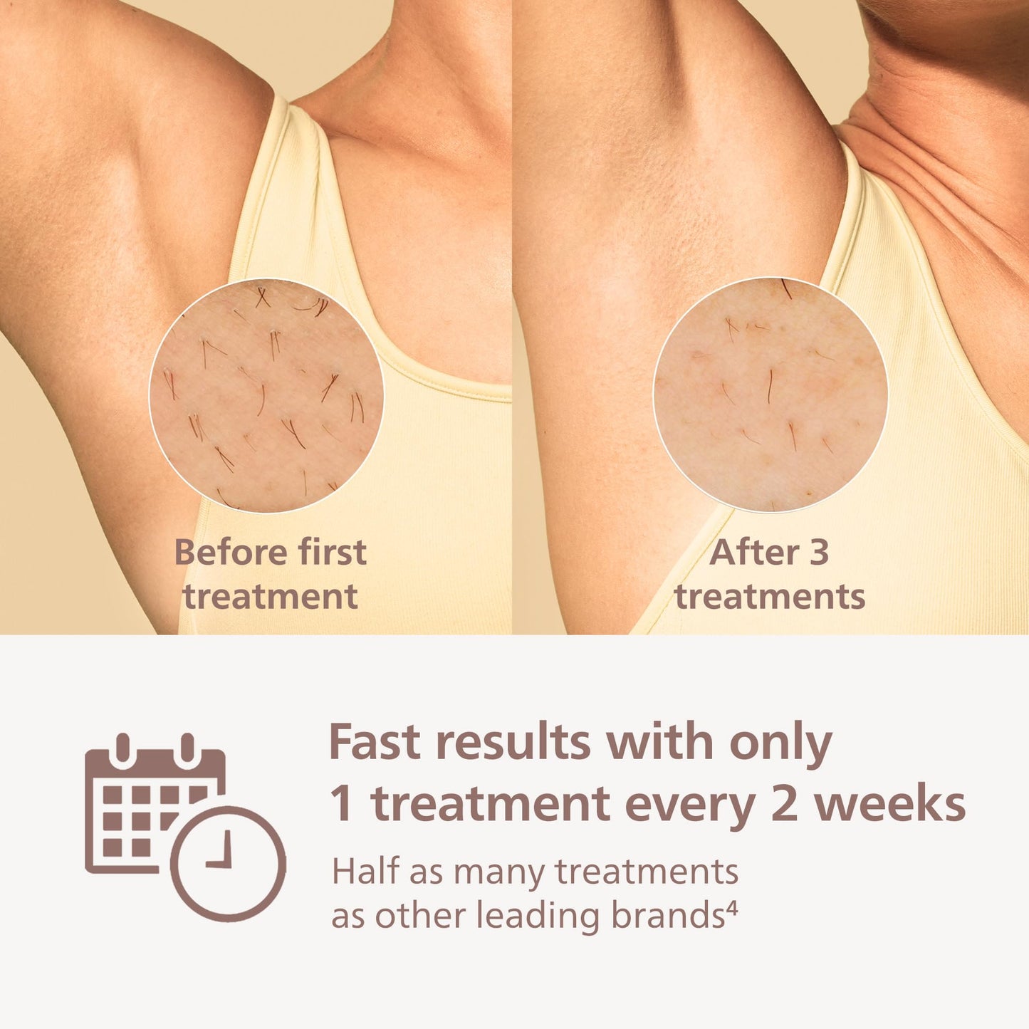 Philips Lumea 7000 Series IPL Hair Removal Device - Permanent Visible Hair Reduction Done at Home, SenseIQ Technology, Uniquely Curved Attachment for Body, for Women & Men, BRI931/03 - Medaid International