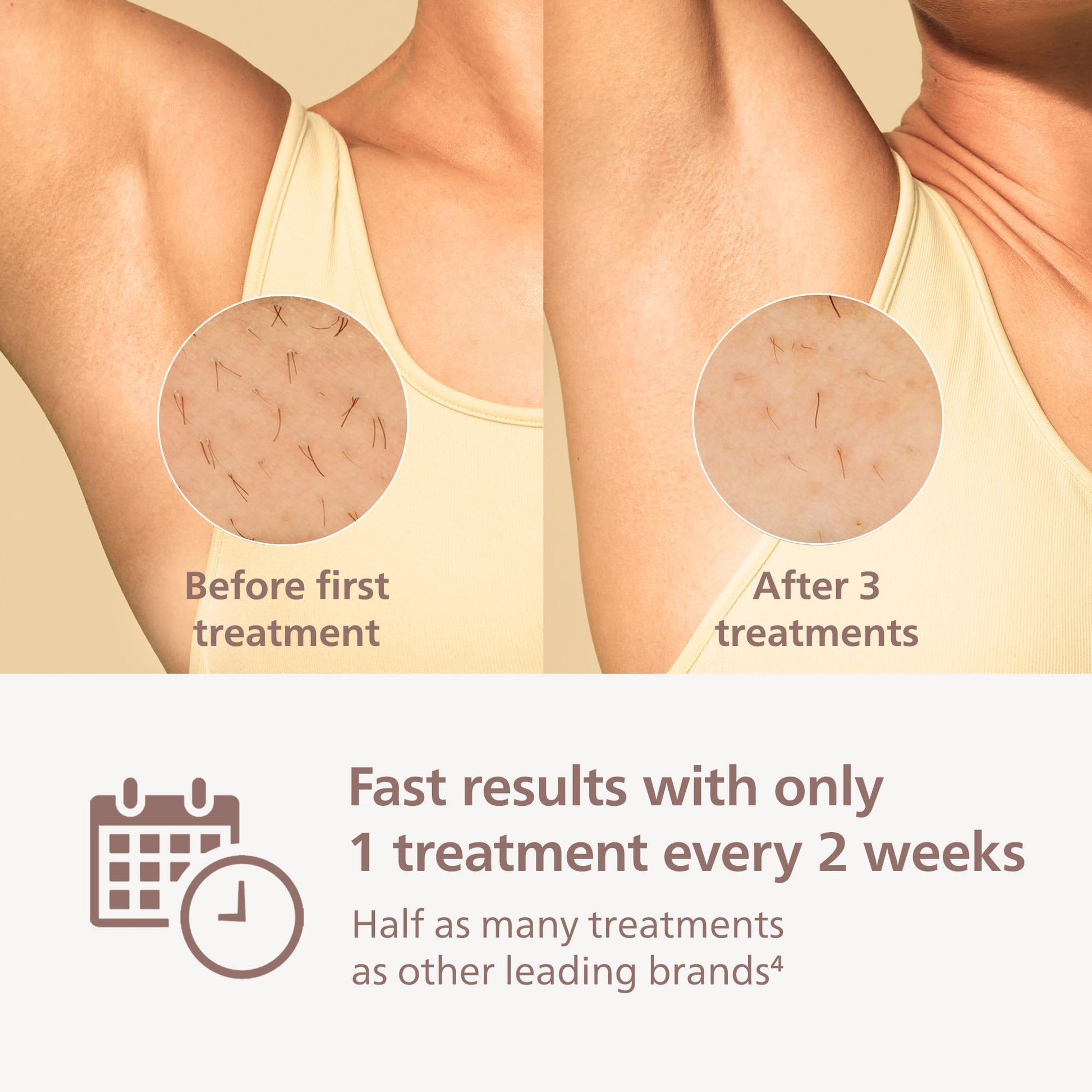 Philips Lumea 7000 Series IPL Hair Removal Device - Permanent Visible Hair Reduction Done at Home, SenseIQ Technology, Uniquely Curved Attachment for Body, for Women & Men, BRI931/03 - Medaid International