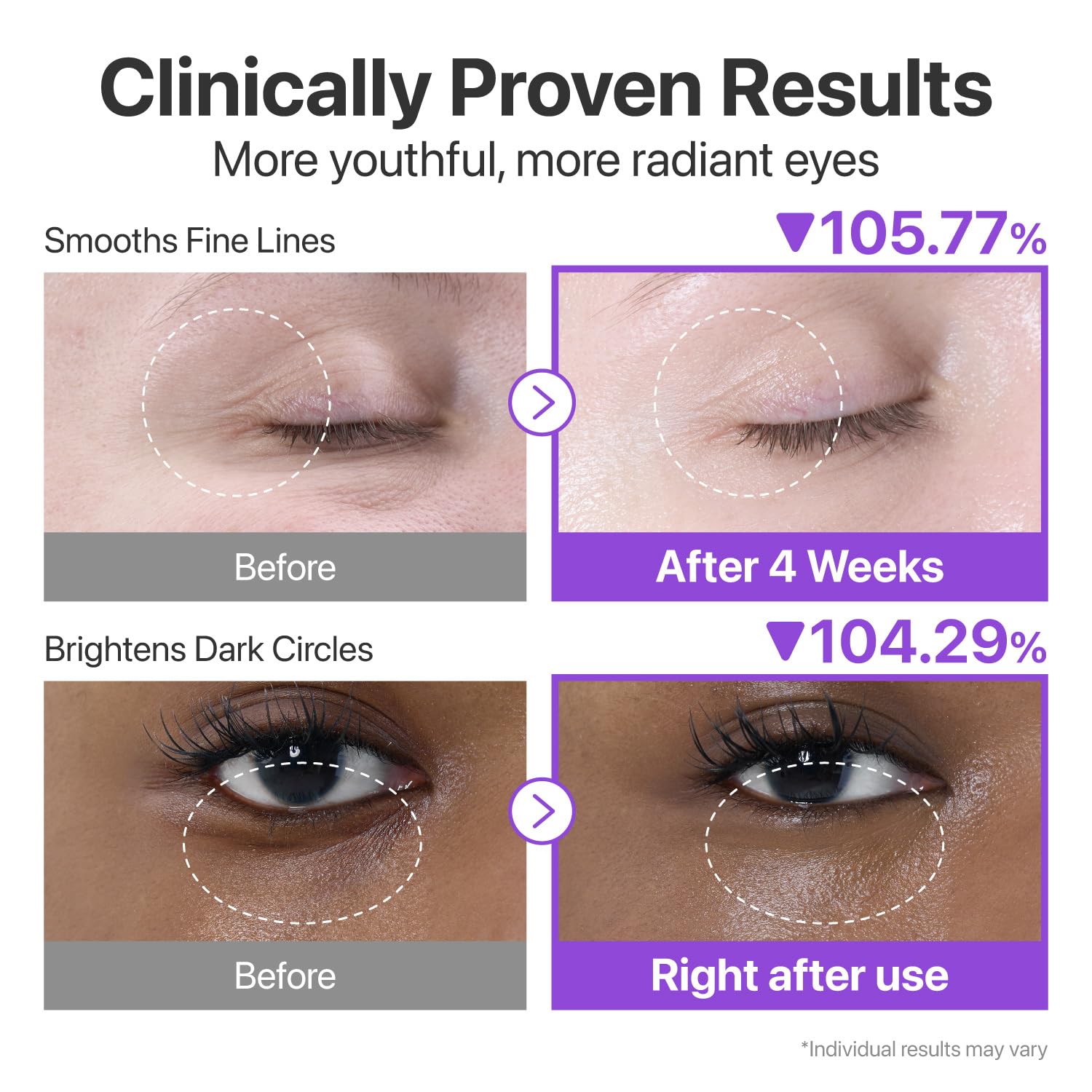 numbuzin No.9 Eye Cream | NAD+ Retinol Volumetox Eye Serum | Dark Circles, Glow Up, Firming, Wrinkles, Fine Lines, Depuff | Peptides, Niacinamide | Restores Radiance for Undereyes | 0.33 fl. oz. - Medaid International
