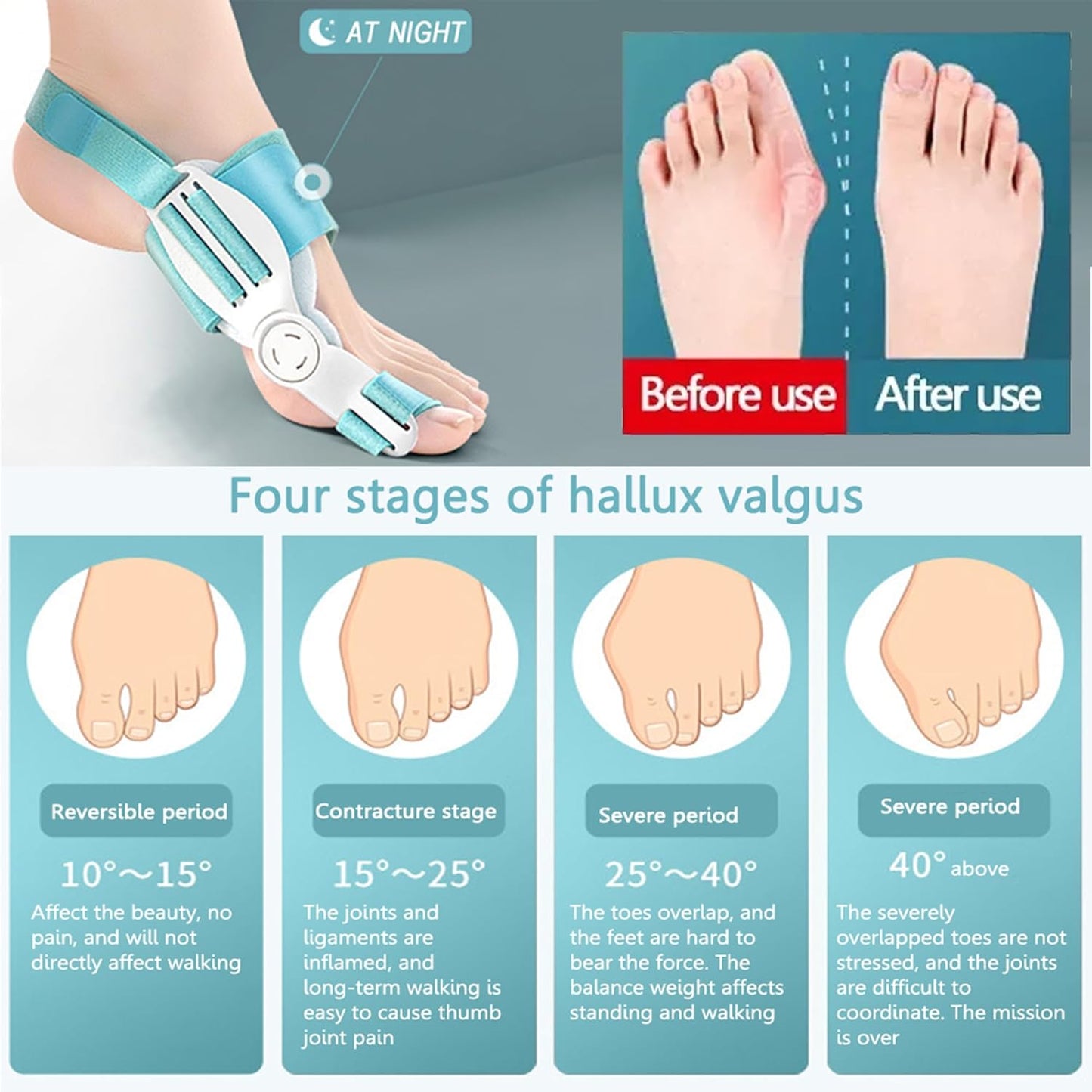 Big Toe Corrector Strap