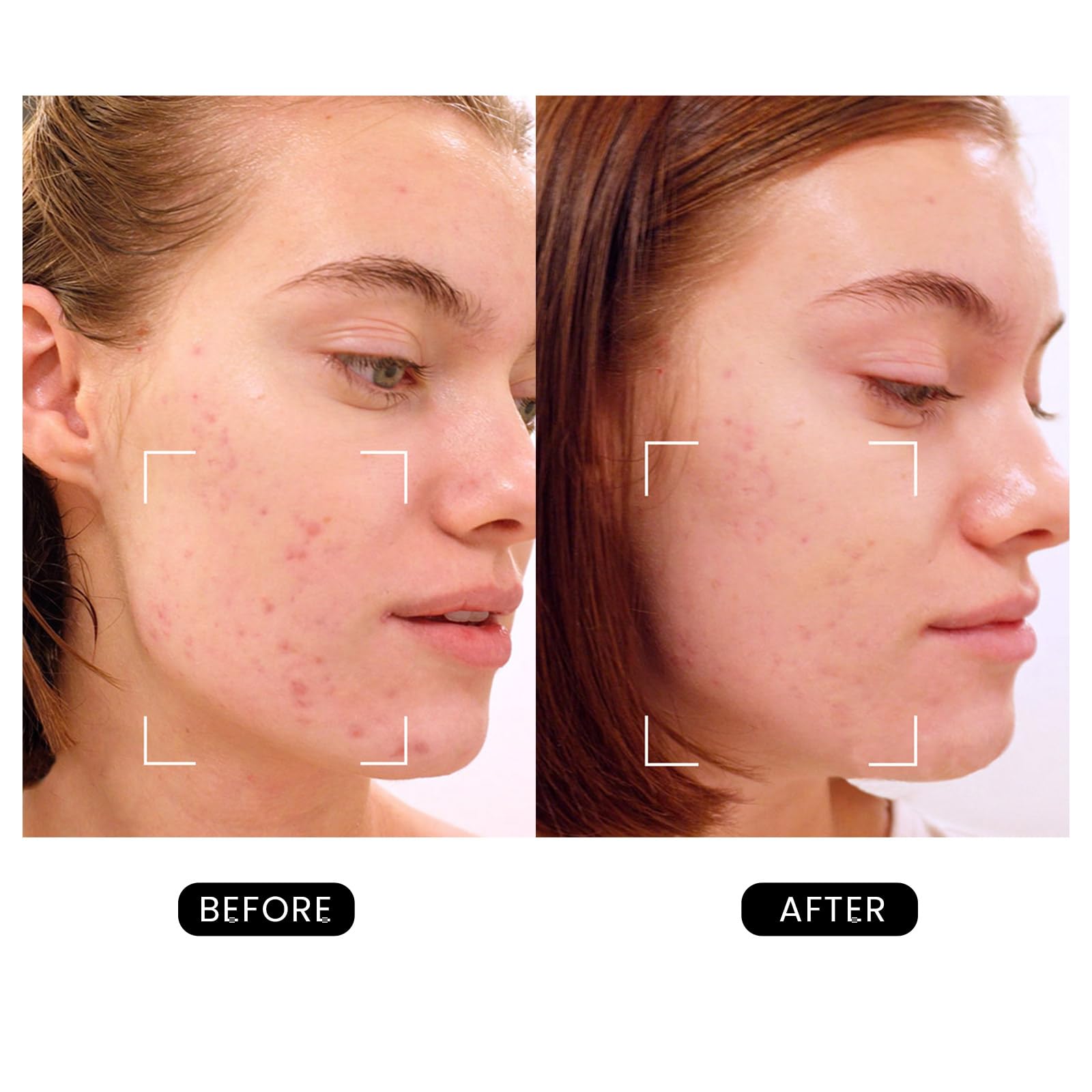 DermRays Revive Skincare for Anti-Aging, Glow Like Never Before,Multifunctional Beauty Device, Facial Massager for Home Use - Medaid International