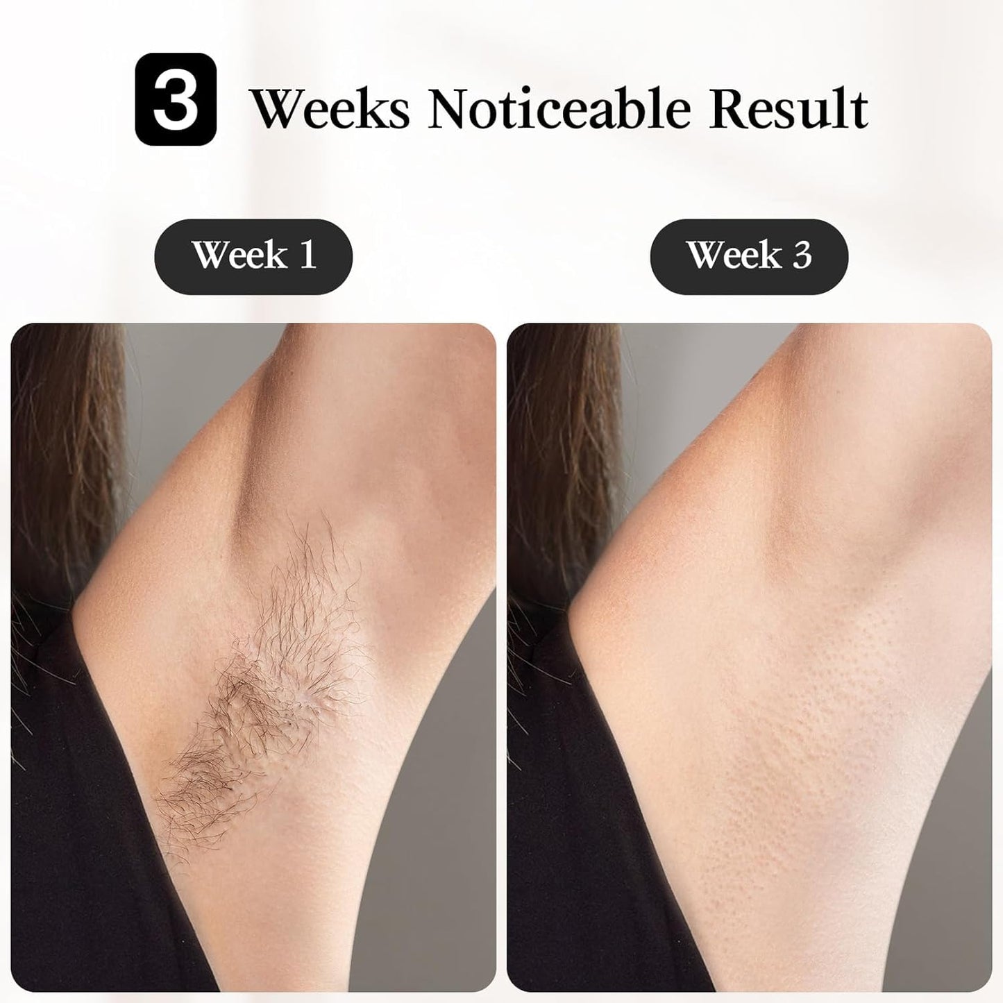 JOVS Laser Hair Removal, [24J Energy] IPL Hair Removal for Women and Men, 37°F Painless Sapphire Ice-Cooling Tech, 6 Modes for Whole Body Hair Removal Device, 2 in 1 Skin Rejuvenation, 330° Rotation - Medaid International
