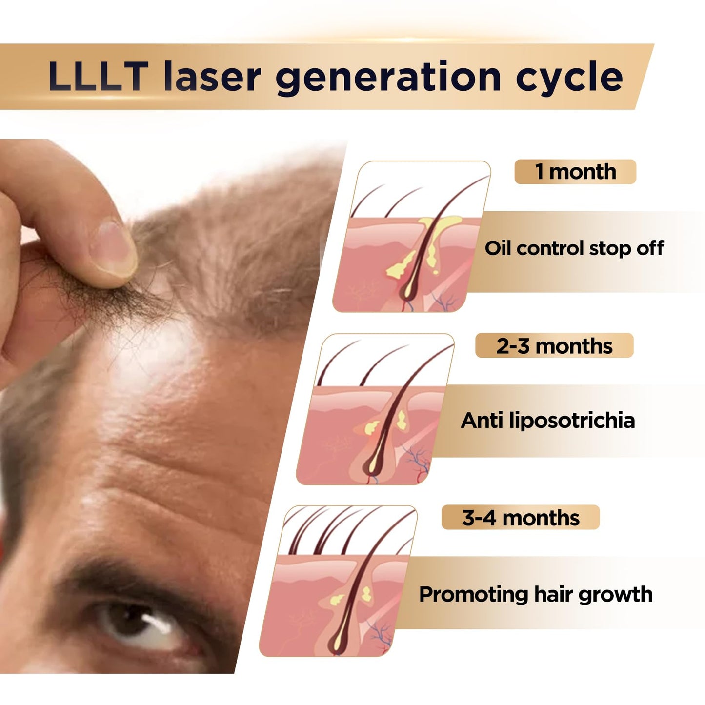 Red Light Therapy for Hair Growth Device - FDA Cleared Hair Loss Treatment - Laser Cap for Hair Regrowth - Hair Thinning & Alopecia Treatment for Men & Women - Medaid International