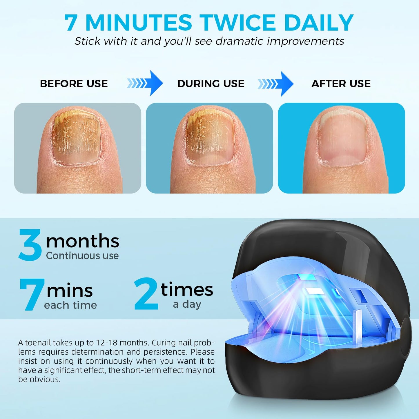 Nail Fungus Laser Treatment LED Light Device-Nail Fungus Light Device,Nail Fungus Cleaning Laser Device-Effective Rechargeable Nail Fungus Remover - Medaid International