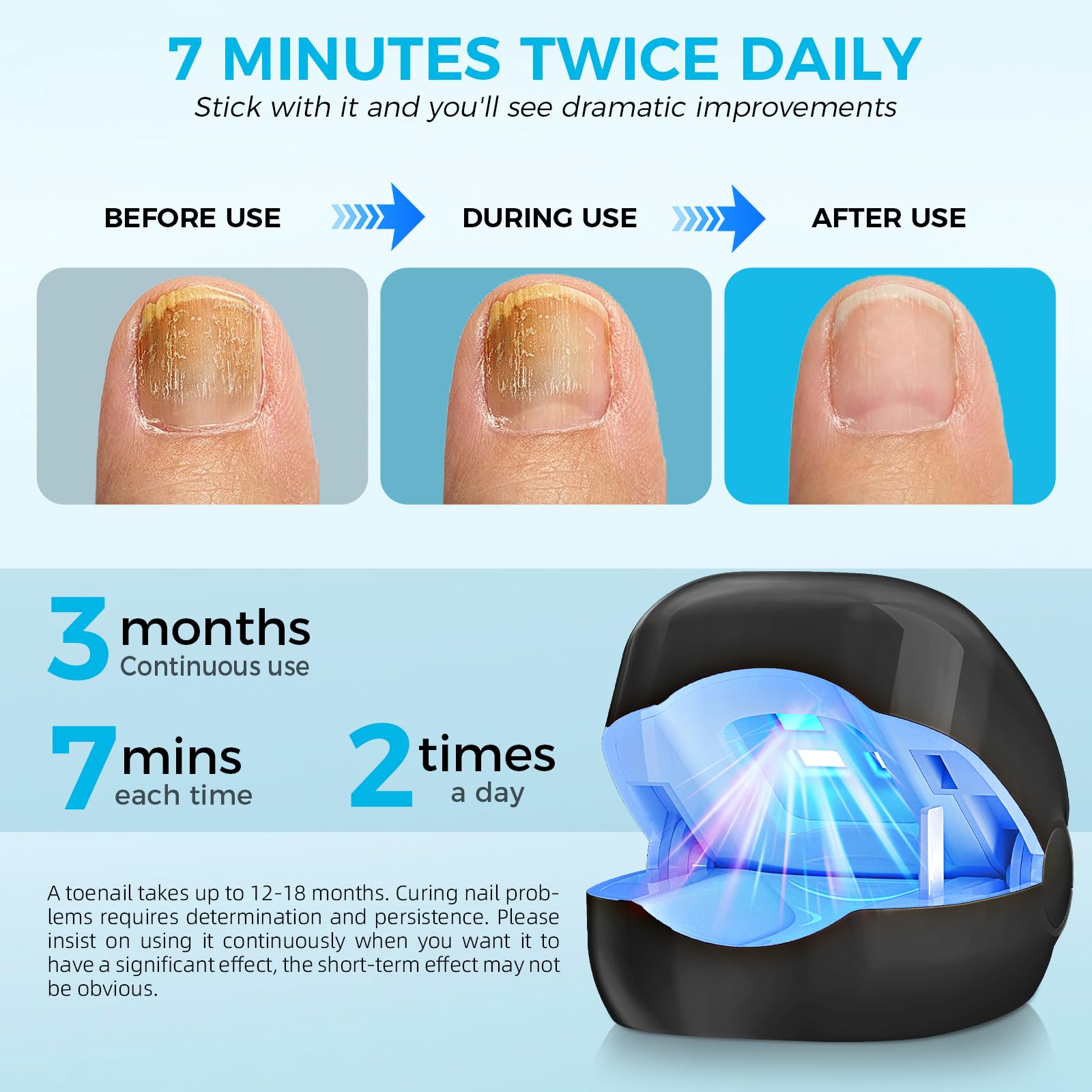 Nail Fungus Laser Treatment LED Light Device-Nail Fungus Light Device,Nail Fungus Cleaning Laser Device-Effective Rechargeable Nail Fungus Remover - Medaid International
