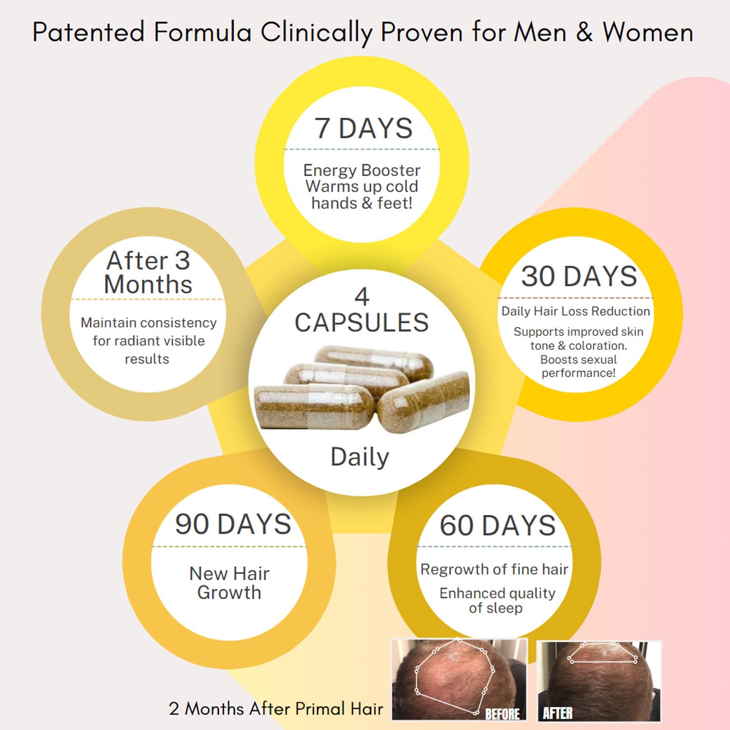 Primal Hair 3 PK- 100% Natural Growth Treatment, Reduces Hair Loss, US Patented Formula Proven Effective for Men & Women, 100% Vegan, Non-GMO, 90-Day Supply, 3 Pack - Medaid International