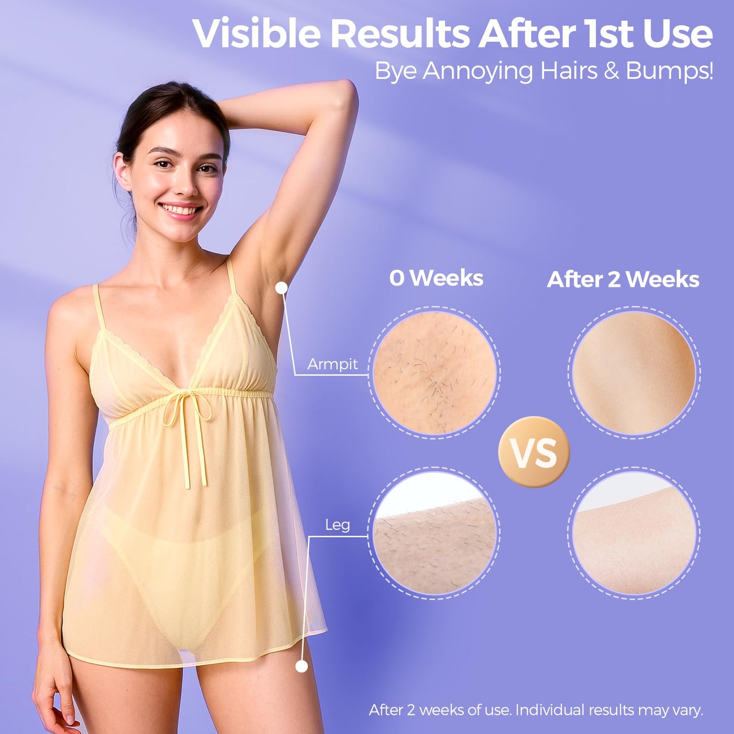 Laser Hair Removal with 5℃ Ice Cooling, Painless IPL Laser Hair Removal Device for Women & Men, 999,999 Flashes, 5 Levels, 2 Modes, Permanent At-Home Hair Removal for Face & Body, with 3 in 1 Set - Medaid International