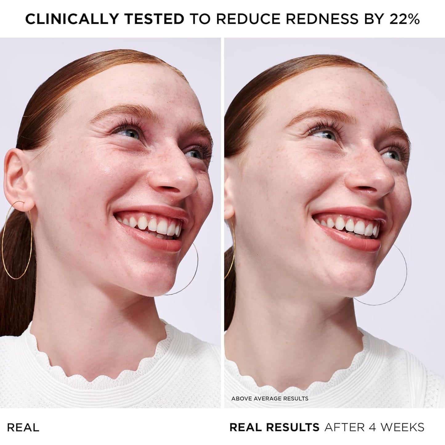 IT Cosmetics Bye Bye Redness Serum - Skin-Calming & Hydrating Face Serum - Instantly Neutralizes Facial Redness - 1% Colloidal Oatmeal, Centella, Peptide & Niacinamide – All Skin Types - 1 fl oz - Medaid International