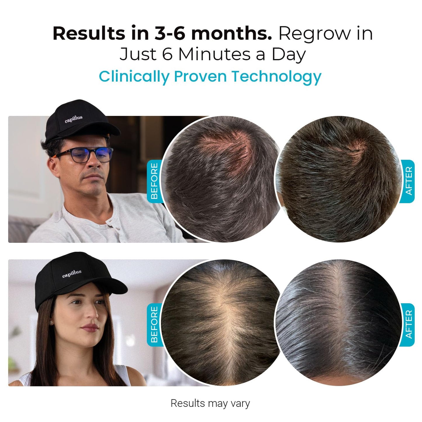 Capillus SPECTRUM Red Light Hair Therapy Hat, Laser Hair Growth Cap, Red Light Therapy for Hair Growth, Hair Red Light Therapy Red Light Cap Hair Regrowth 312 Low Level Laser Therapy + Bluetooth App - Medaid International
