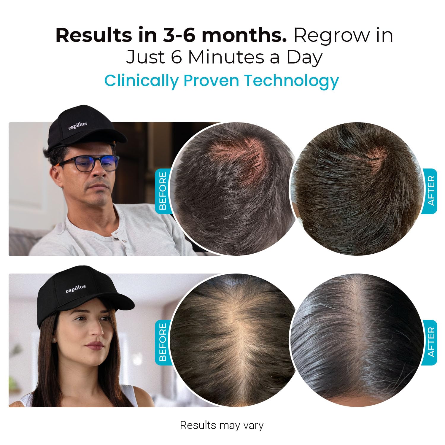Capillus SPECTRUM Red Light Hair Therapy Hat, Laser Hair Growth Cap, Red Light Therapy for Hair Growth, Hair Red Light Therapy Red Light Cap Hair Regrowth 312 Low Level Laser Therapy + Bluetooth App - Medaid International