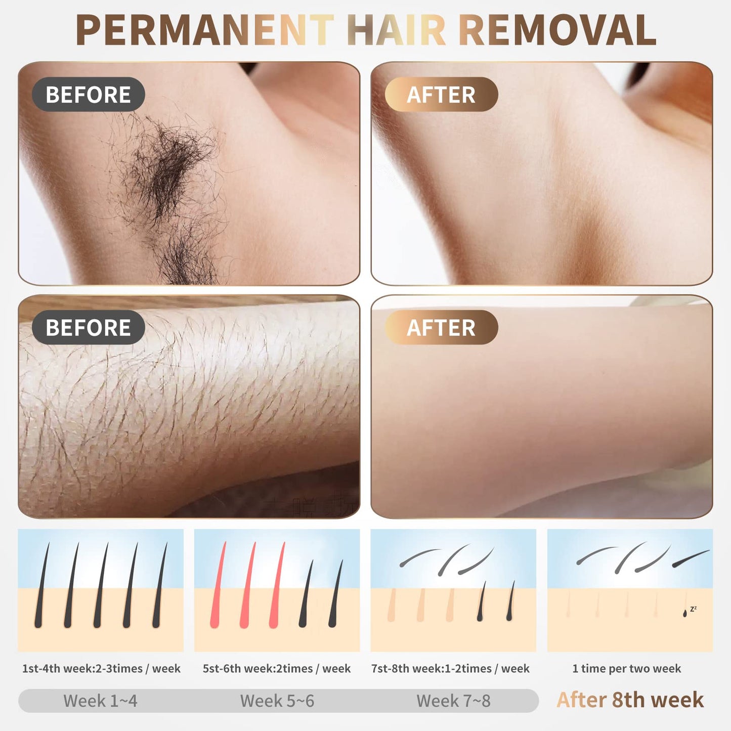 Gransumr IPL Laser Hair Removal Device at-Home Permanent Painless Hair Remover for Women and Men Best Whole Body Facial Face Armpits Back Legs Arms Face Bikini Line - Medaid International