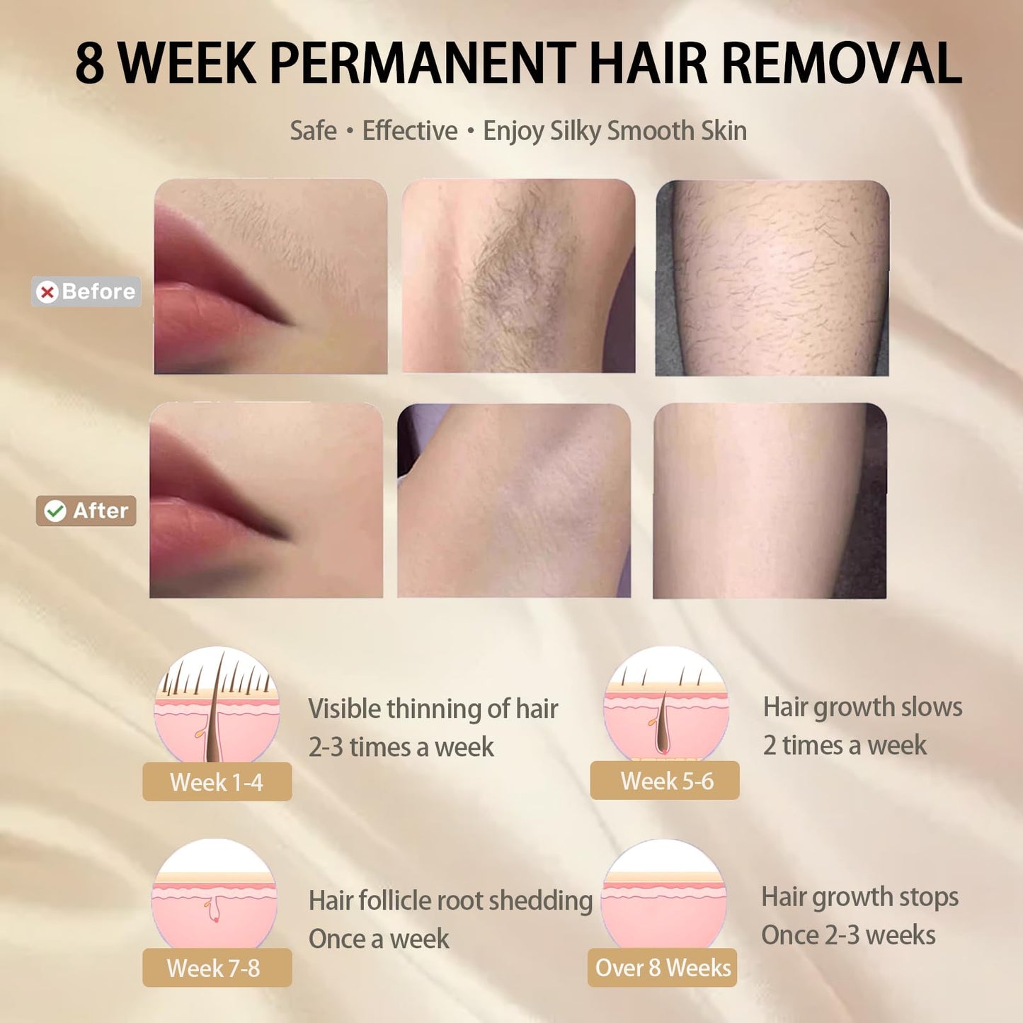 Laser Hair Removal with Ice Cooling for Women and Men 999,999 Flashes IPL Hair Remover Device 5 Adjustable Levels for Legs Underarm Arm Face Body, Corded - Medaid International