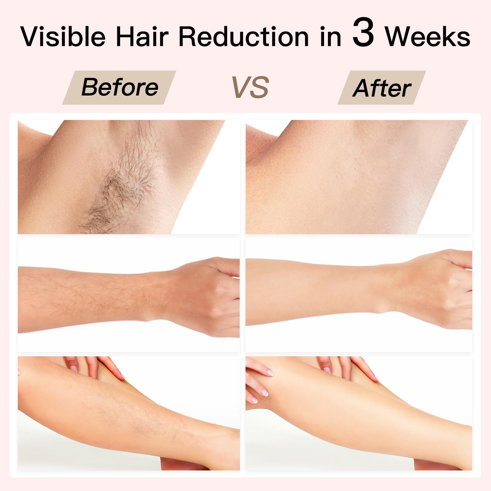 Laser Hair Removal, BoSidin IPL Hair Removal with Painless Ice-Cooling, 2-in-1 Face SR Rejuvenation, 6+1 Modes, 6 Levels Hair Removal for Women Permanent, Laser Hair Removal Kit with Shaver, Goggles - Medaid International