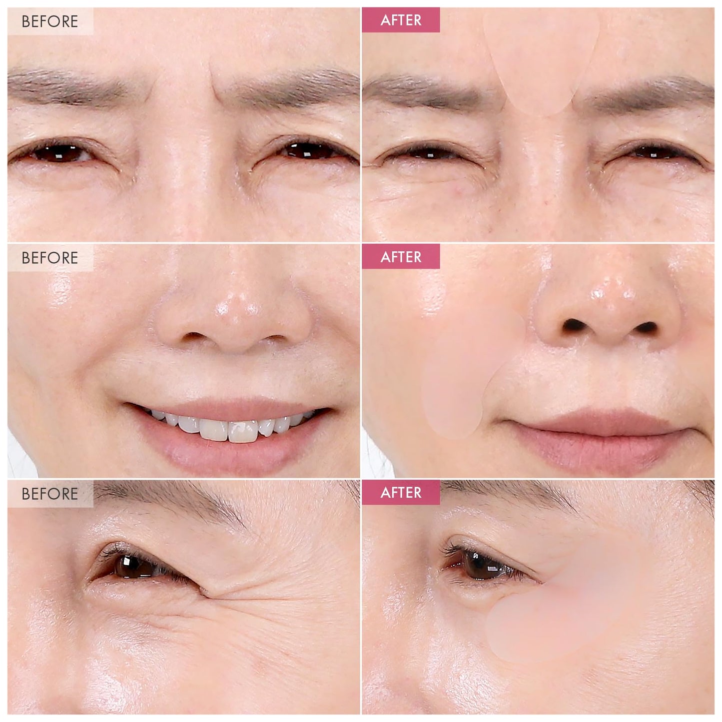 TOSOWOONG Anti-Wrinkle Patch with Hydrolyzed Collagen, Forehead & Eye & Smile Line Wrinkle Patches, Anti-Wrinkle Tape, K-Beauty Overnight Under Eye Patches, Korean Skincare, 5ea (10patches X 5) - Medaid International