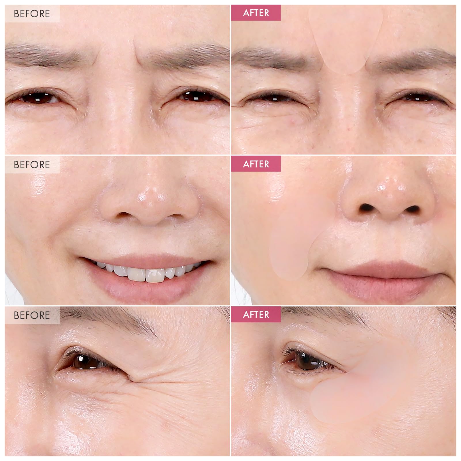 TOSOWOONG Anti-Wrinkle Patch with Hydrolyzed Collagen, Forehead & Eye & Smile Line Wrinkle Patches, Anti-Wrinkle Tape, K-Beauty Overnight Under Eye Patches, Korean Skincare, 5ea (10patches X 5) - Medaid International