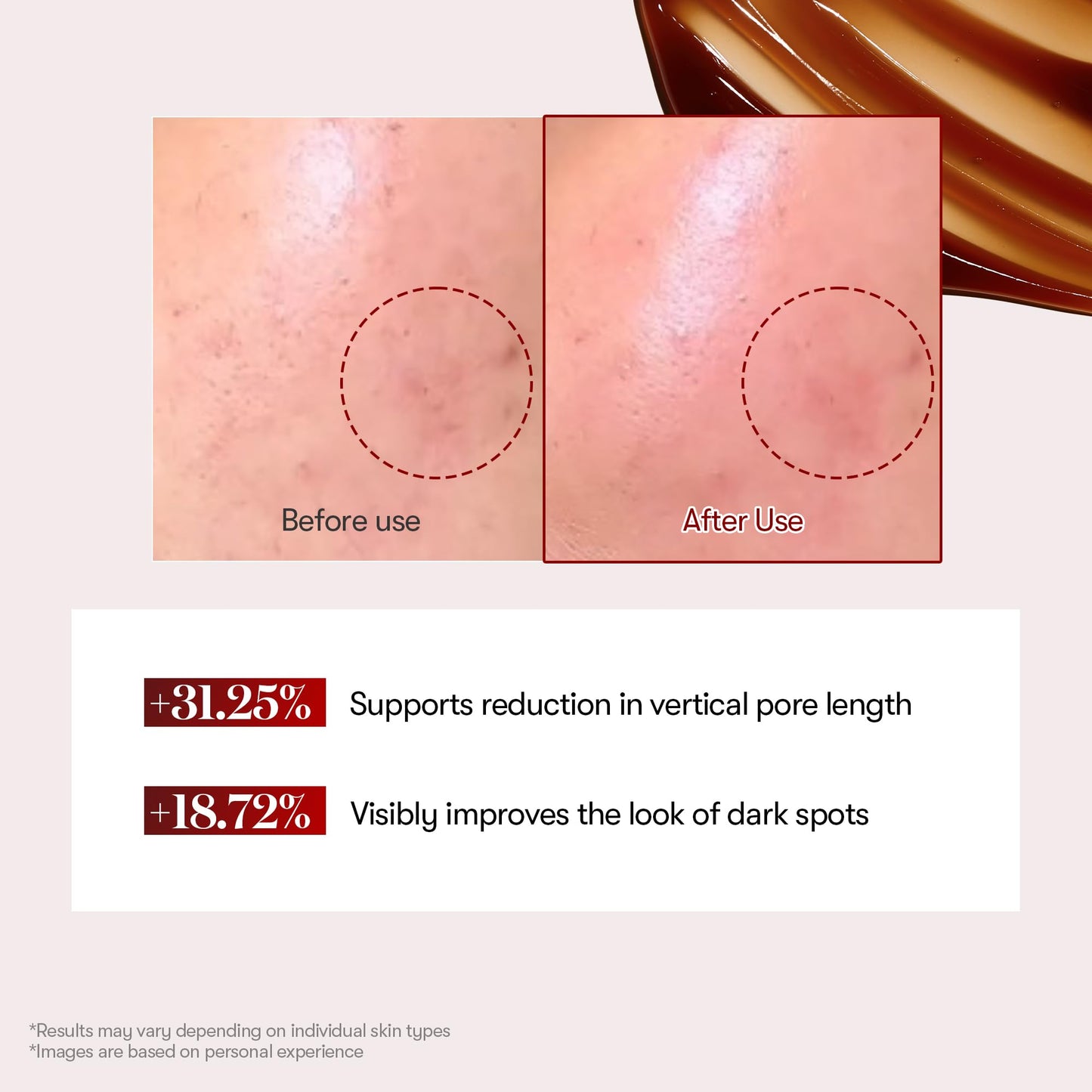VT COSMETICS Red Booster Reedle Shot 100, Microneedling Serum with Dragon’s Blood, Exosome, Soothing Relief Serum for Irritated, and Sun-Stressed Skin, Scalp Care, Korean Skincare 1.69 fl oz (50ml) - Medaid International