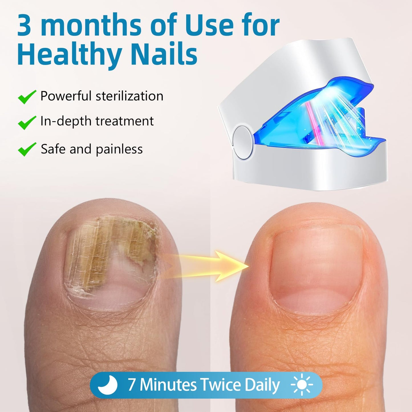Nail Fungus Laser Treatment LED Light Device-Effective Rechargeable Nail Fungus Remover for Home Use - Medaid International