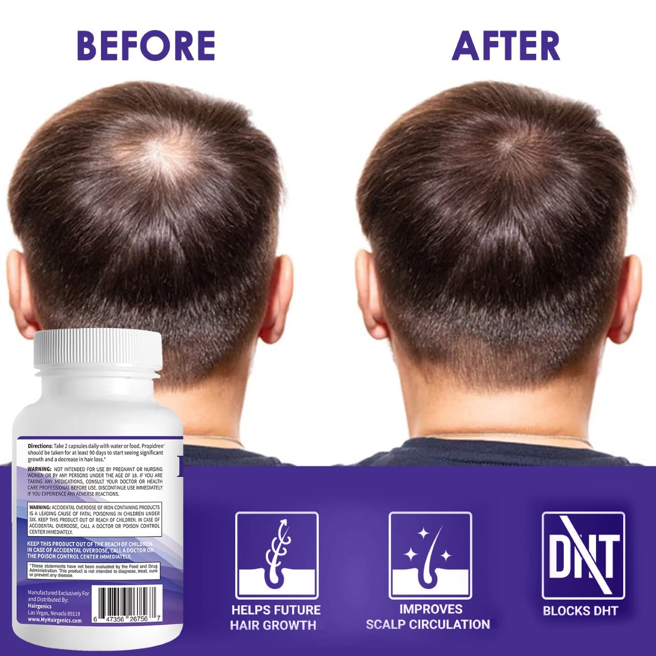 Propidren by HairGenics - DHT Blocker & Hair Growth Capsules to Prevent Hair Loss & Stimulate Hair Follicles, to Stop Hair Loss & Regrow Hair. Proprietary Anti-Hair Loss & Hair Regrowth Treatment. - Medaid International